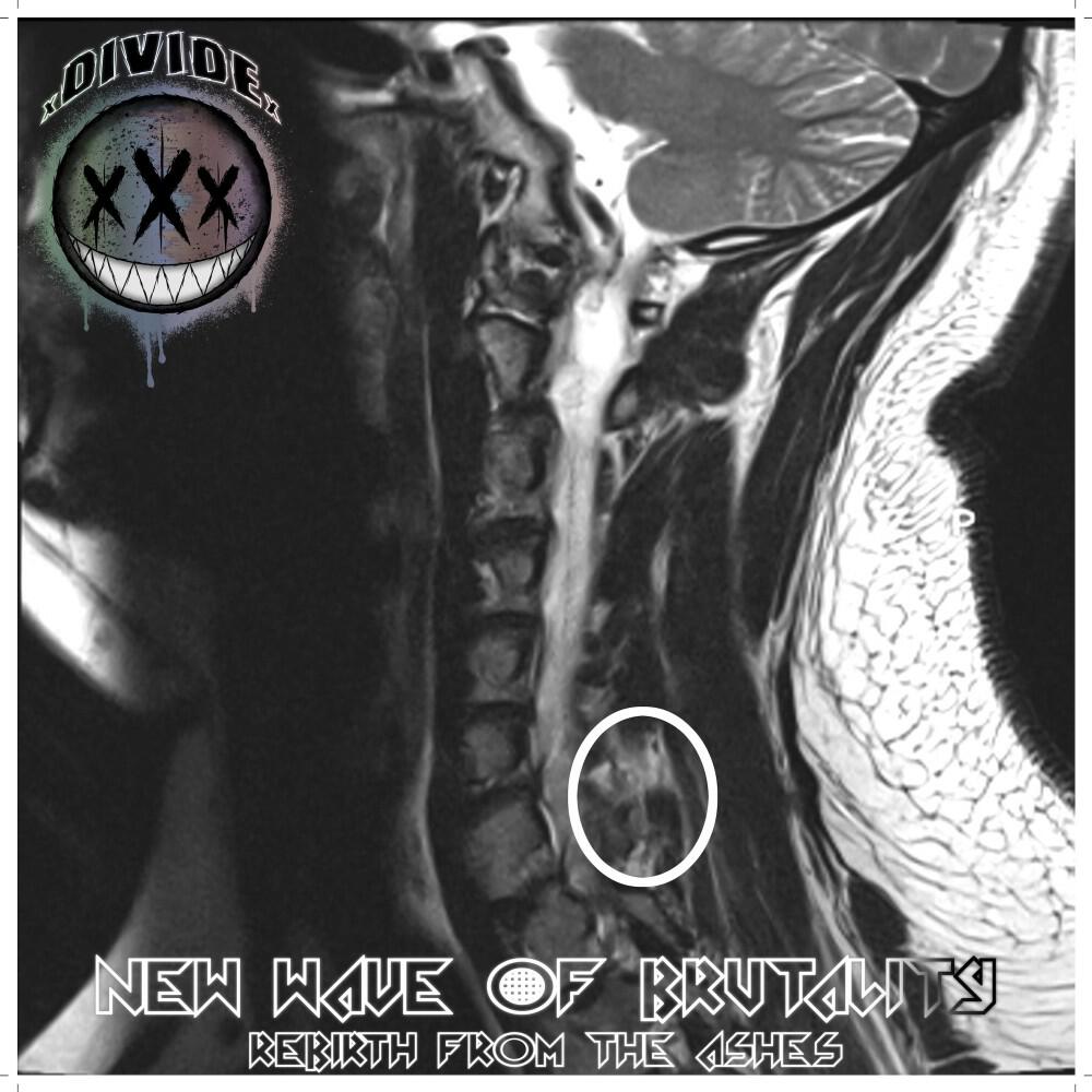 Релиз New Wave of Brutality: Rebirth from the Ashes
