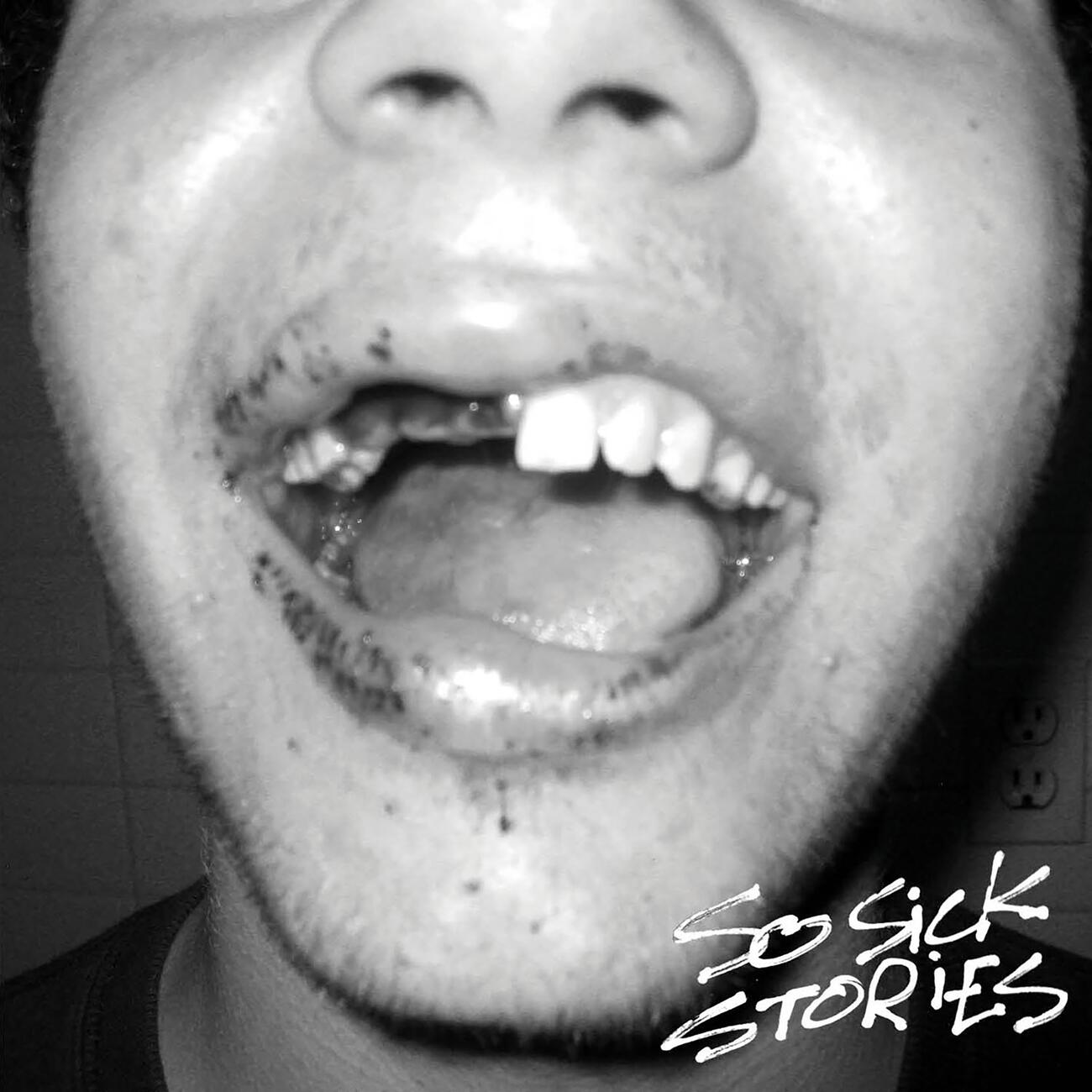 Релиз So Sick Stories
