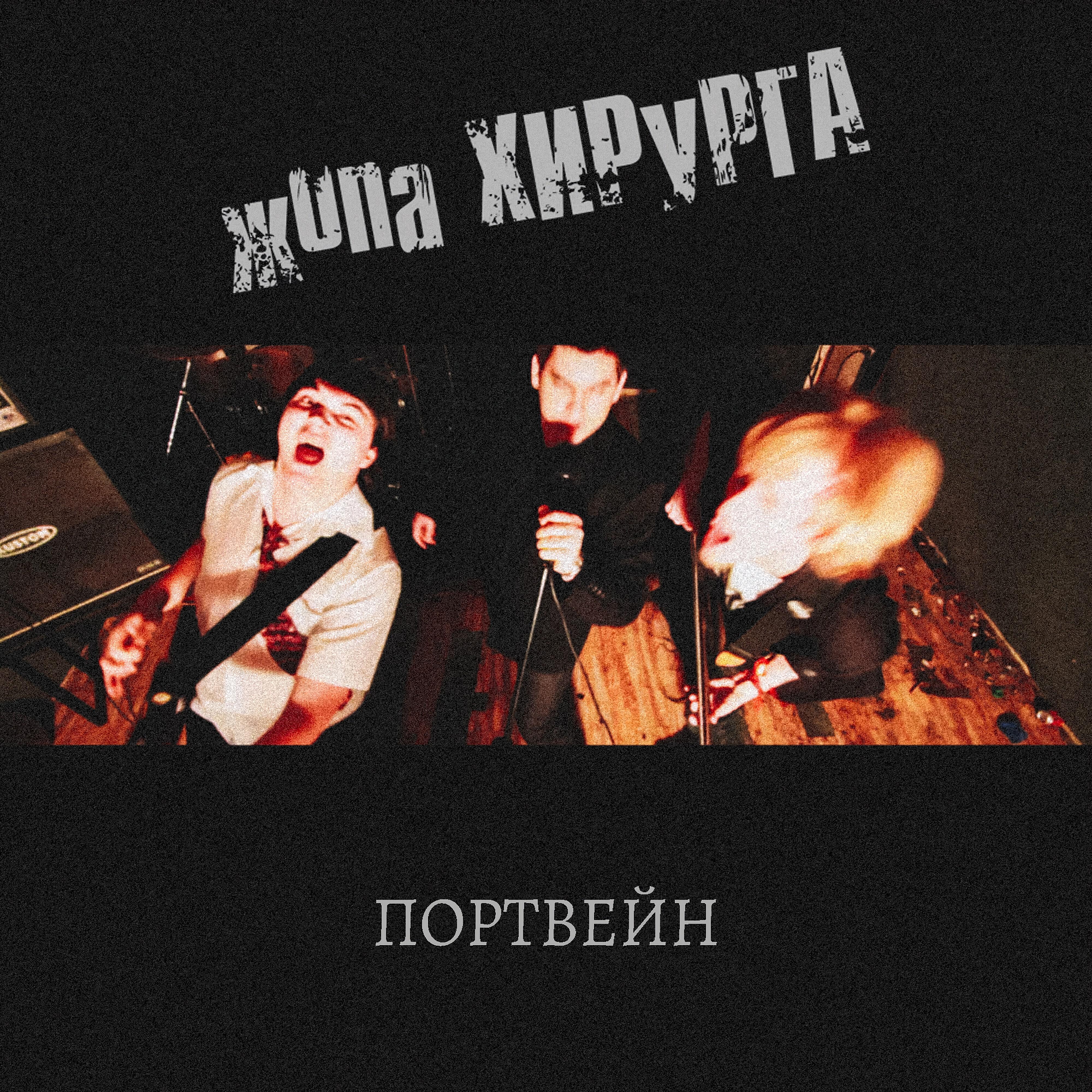 Жопа Хирурга