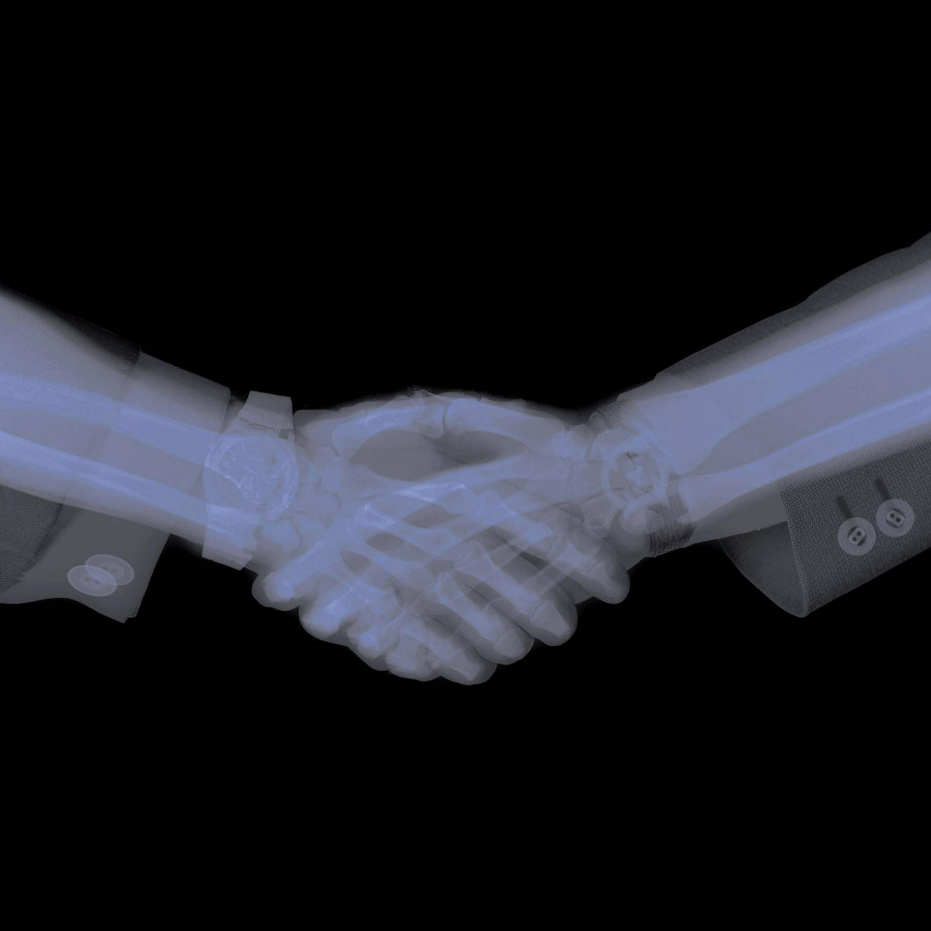 Релиз Broken Fingers