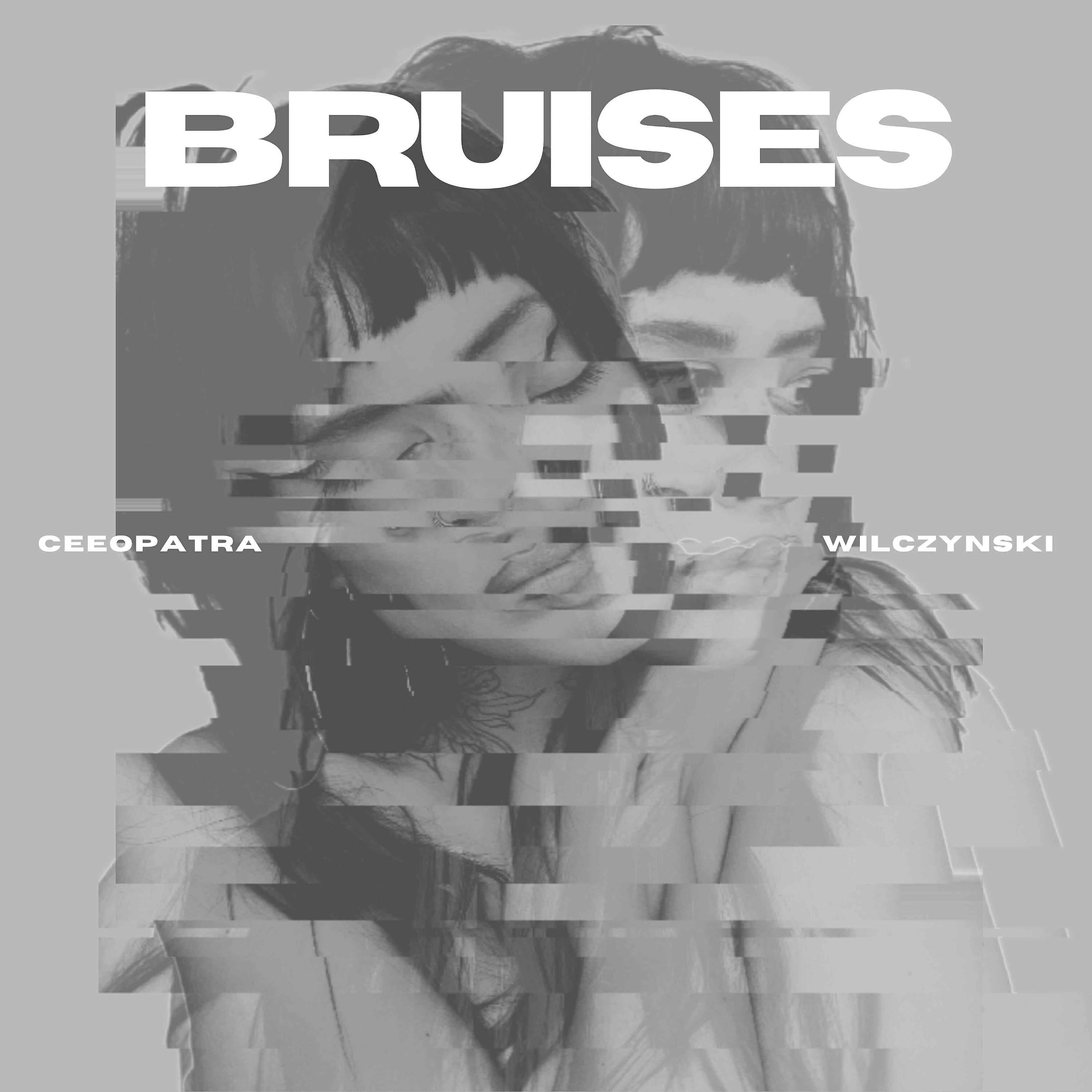 Релиз Bruises