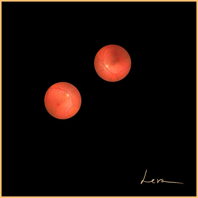 Релиз Lera II