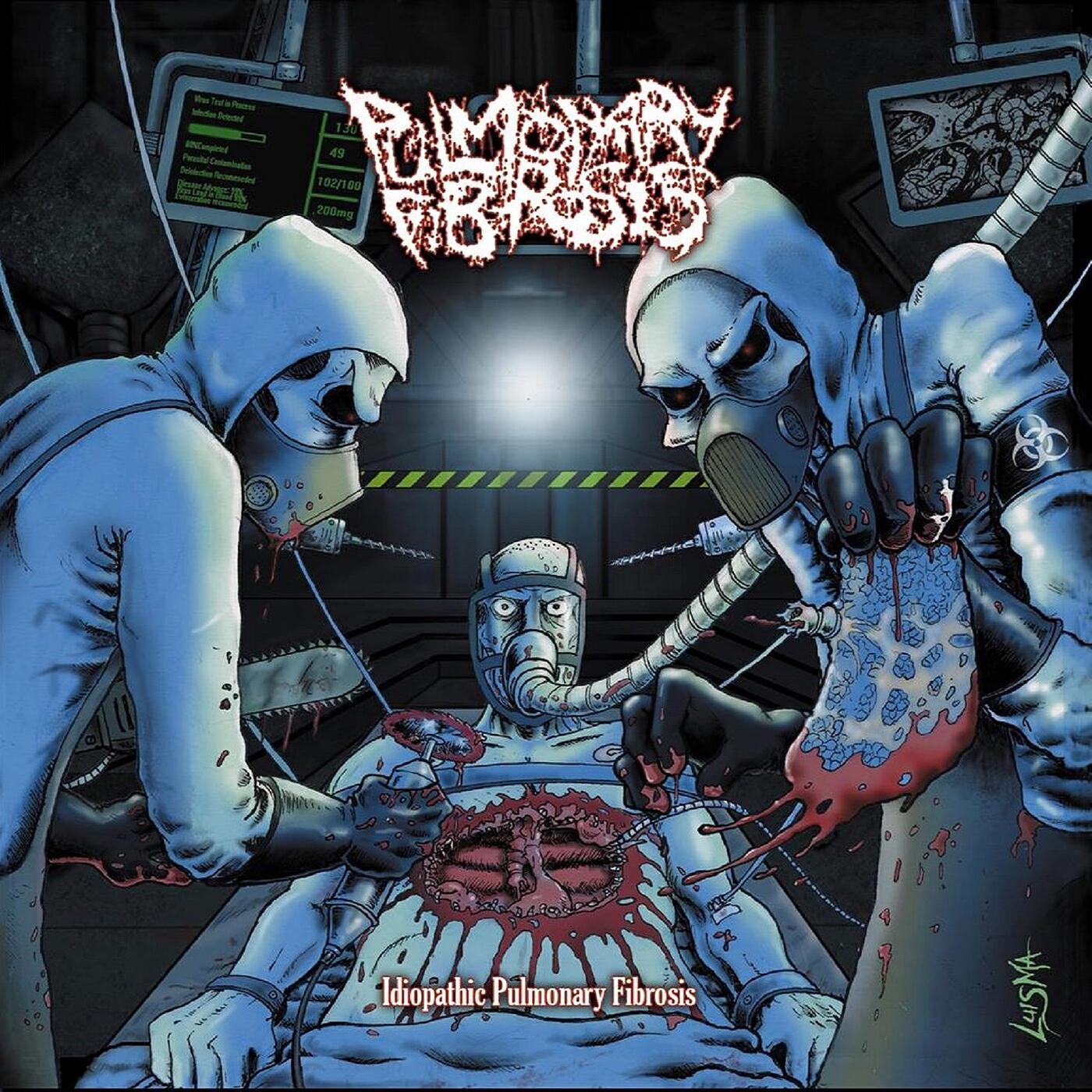Релиз Idiopathic Pulmonary Fibrosis