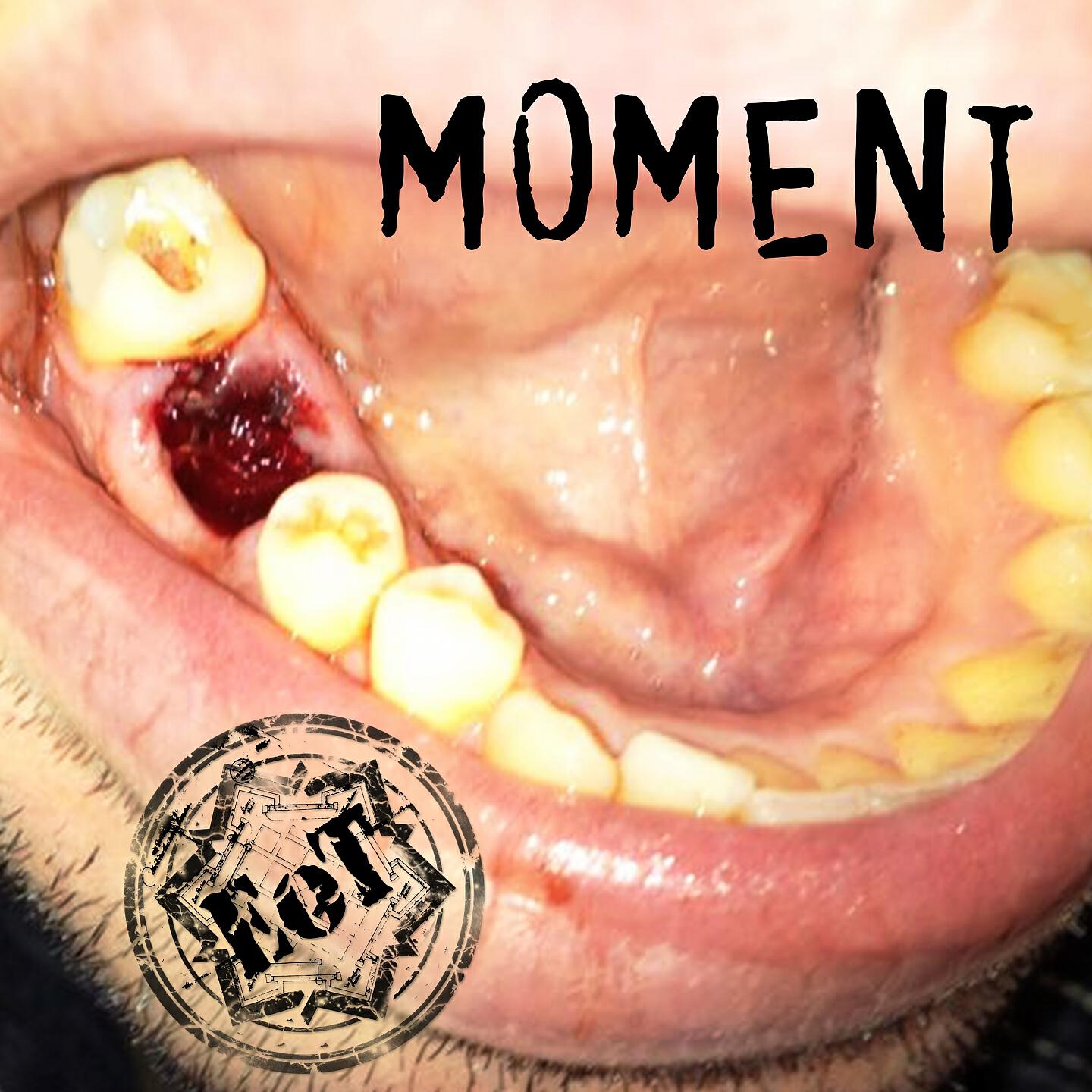 Релиз Moment