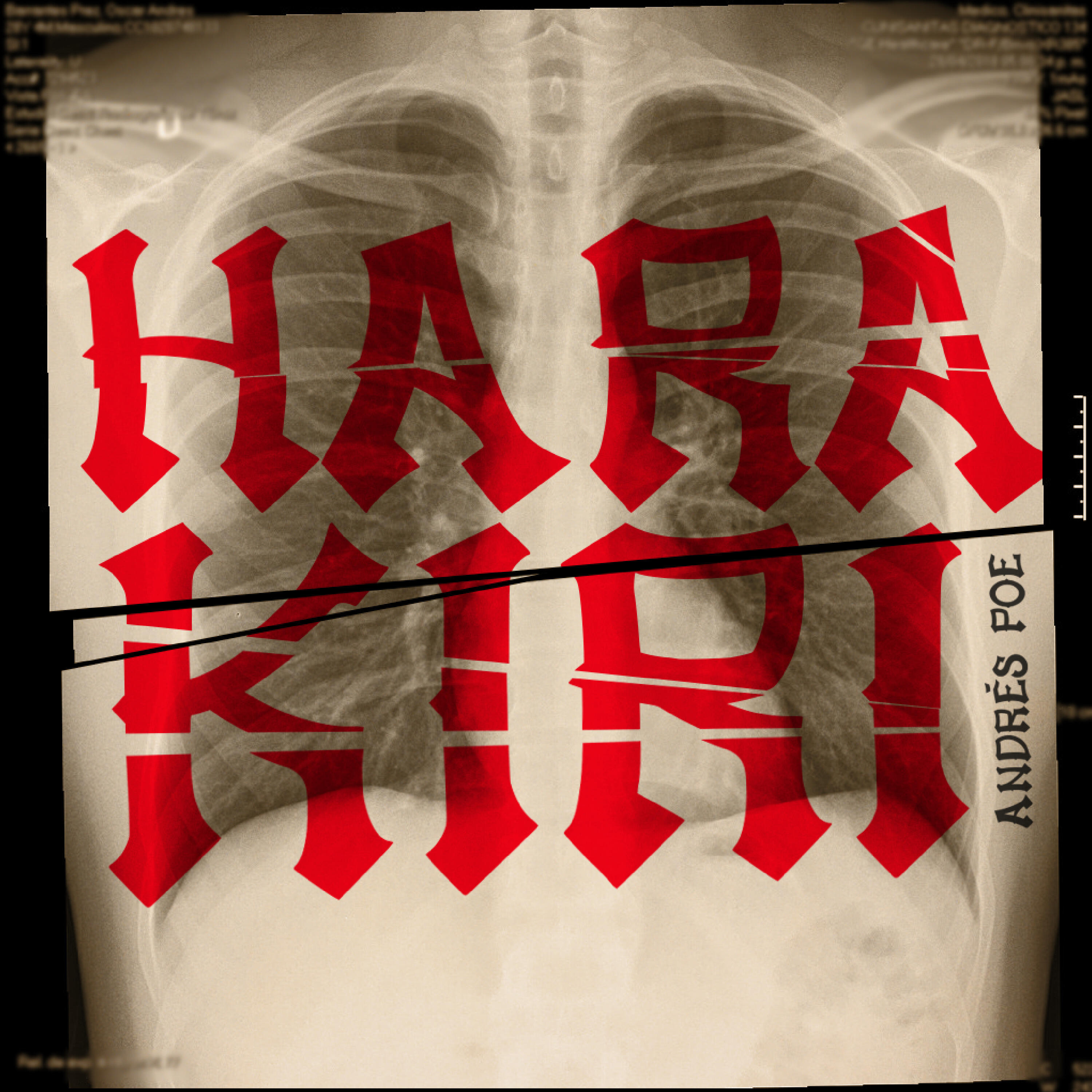 Релиз Harakiri