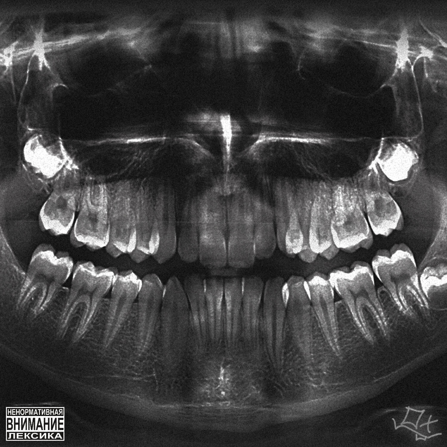 Релиз Kingy Mnc Flow