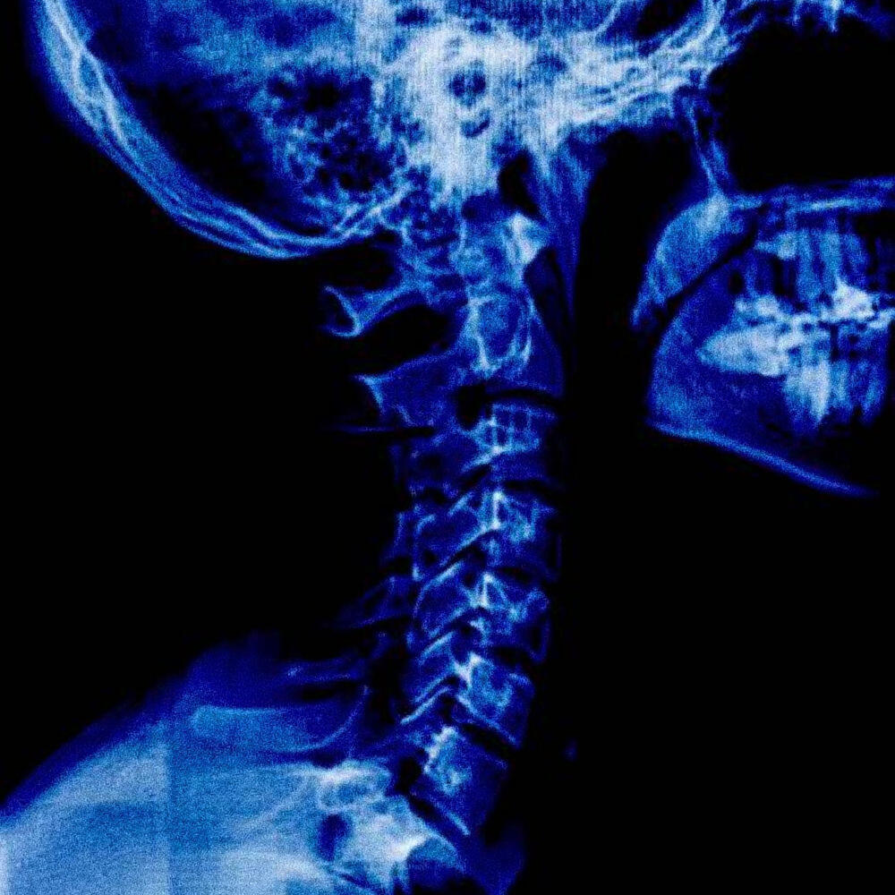 Venting Palace