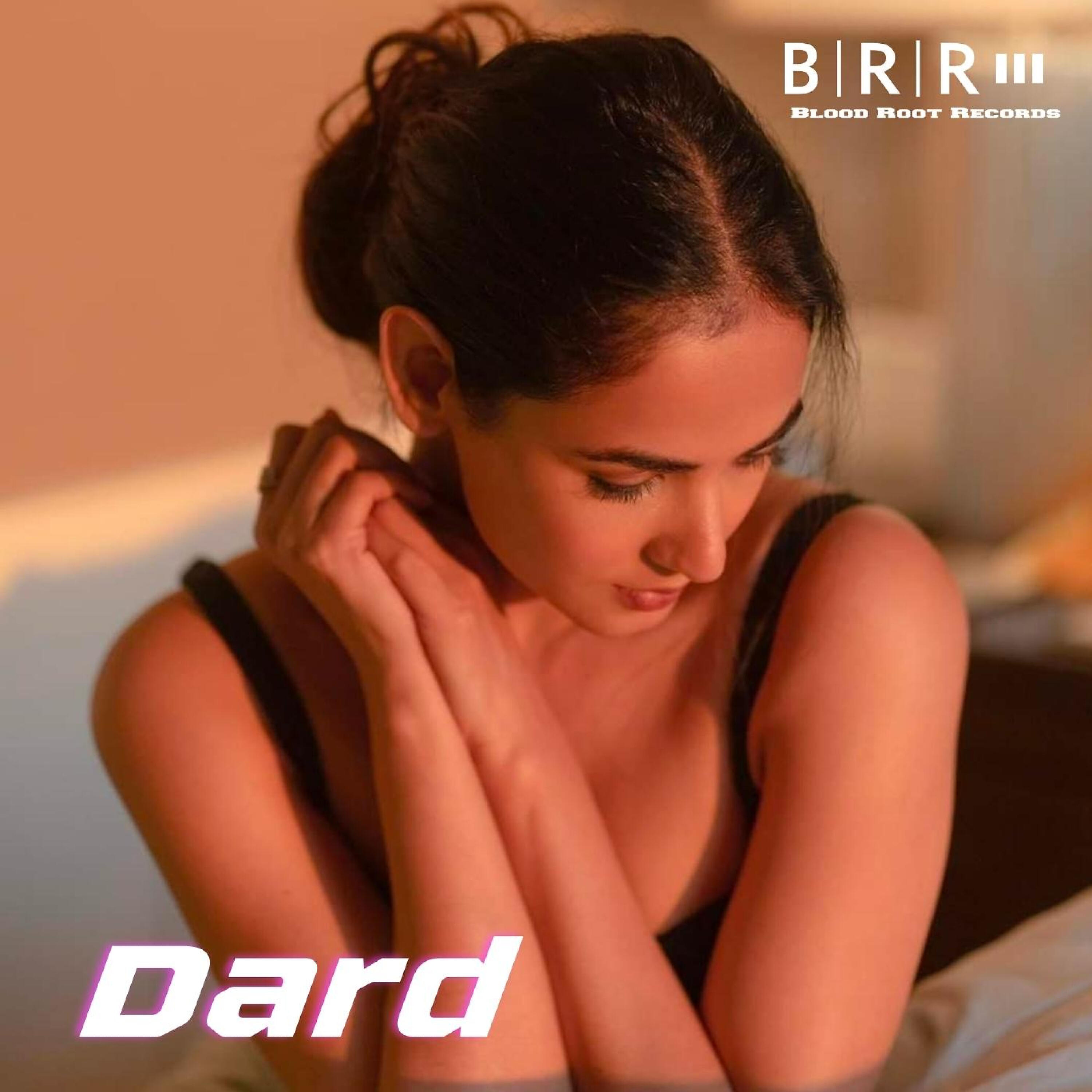Релиз Dard