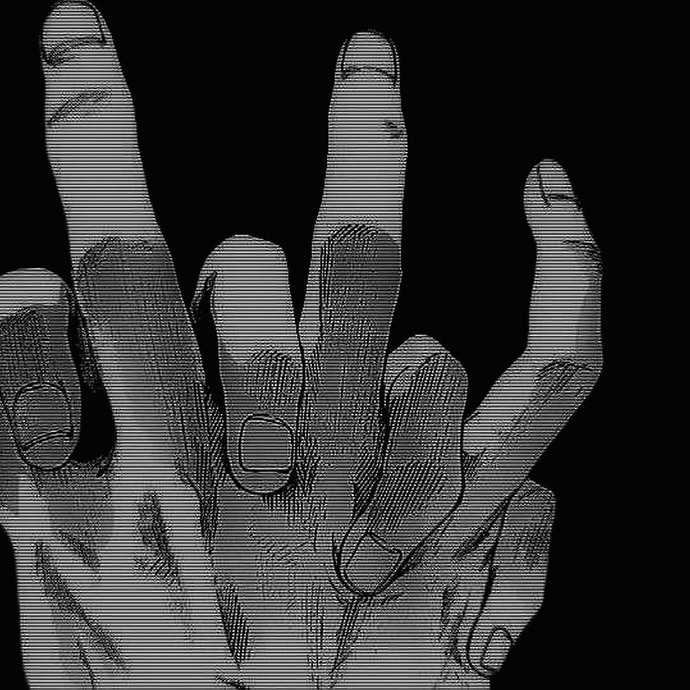 MVDXC
