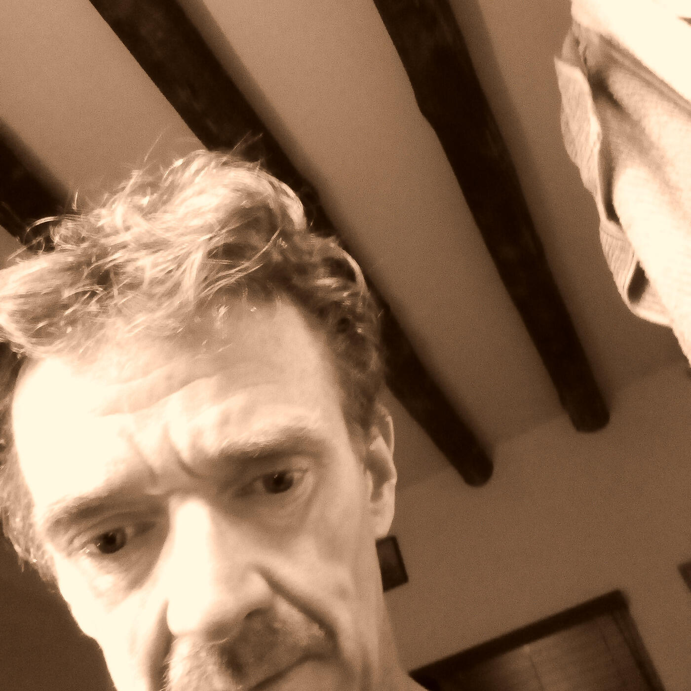 Релиз I Know It Hurts Too