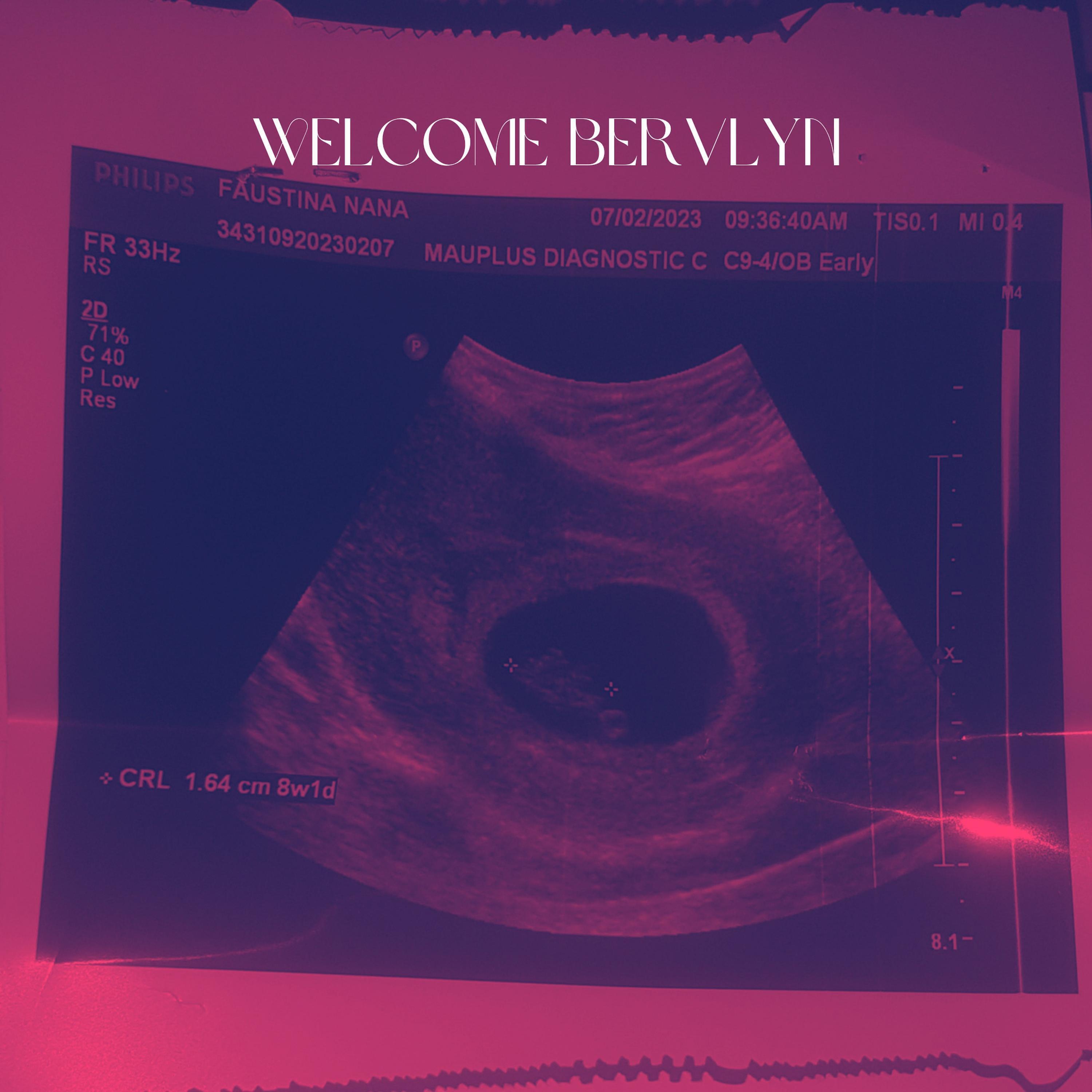 Релиз Welcome Bervlyn