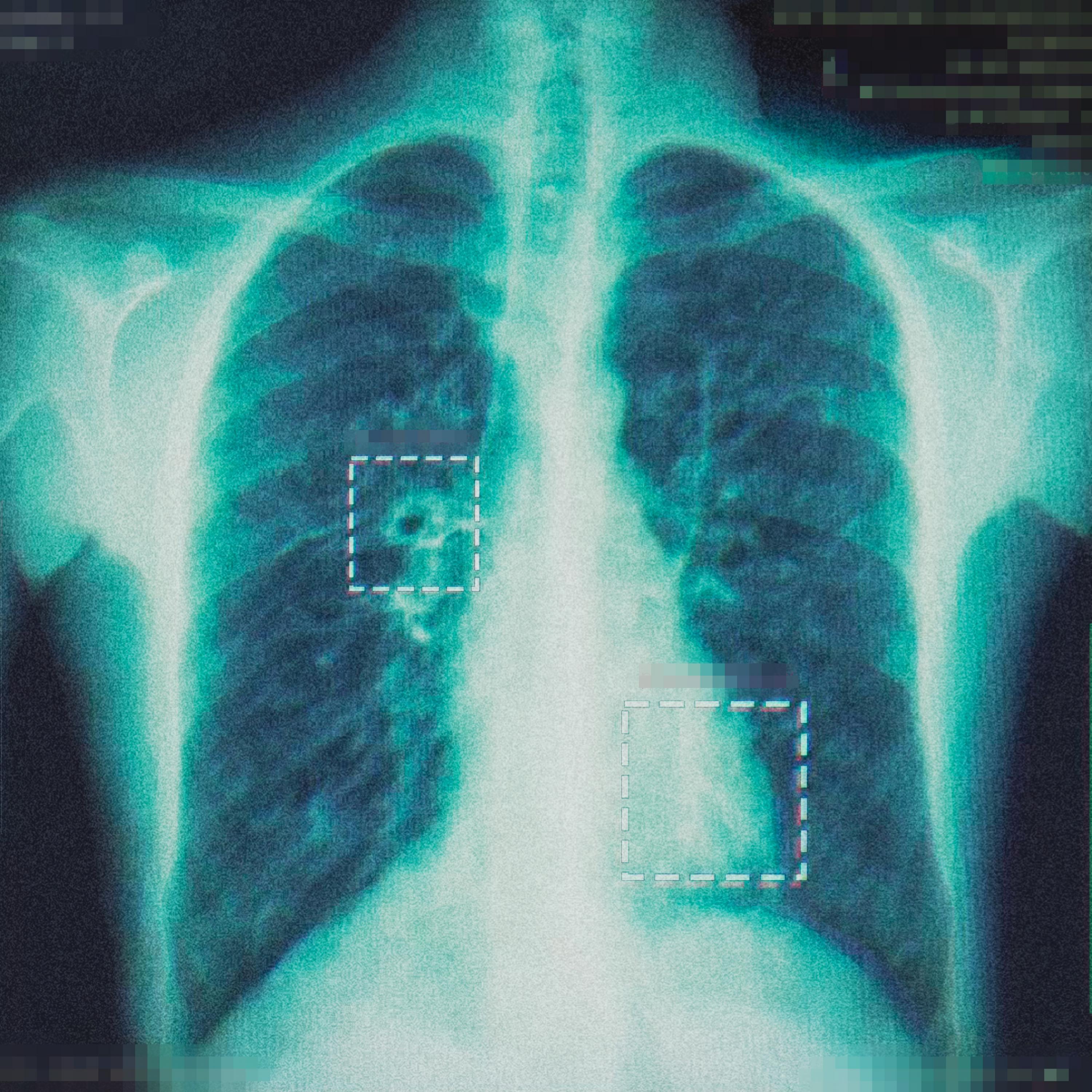 Релиз OXYGEN