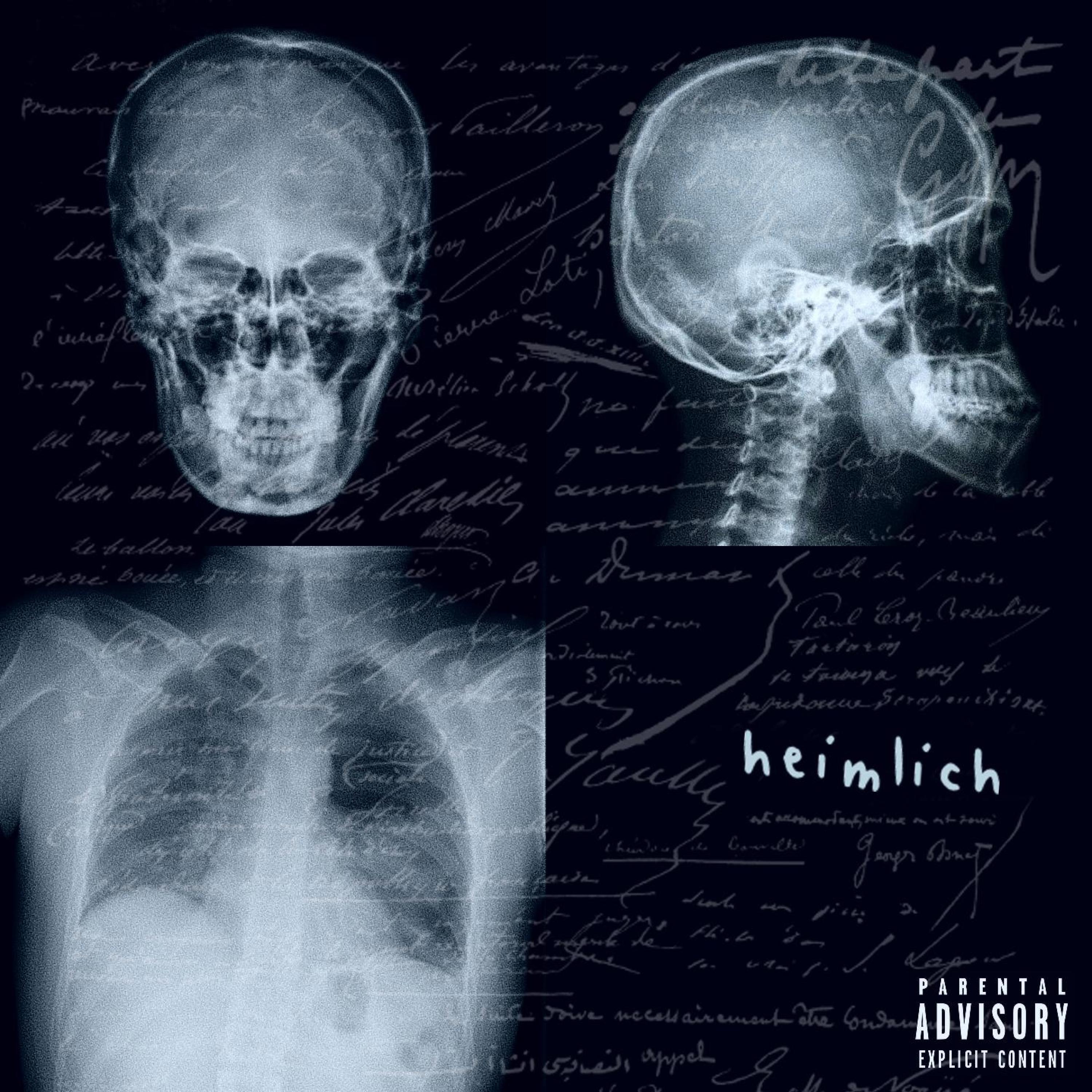 Релиз HEIMLICH