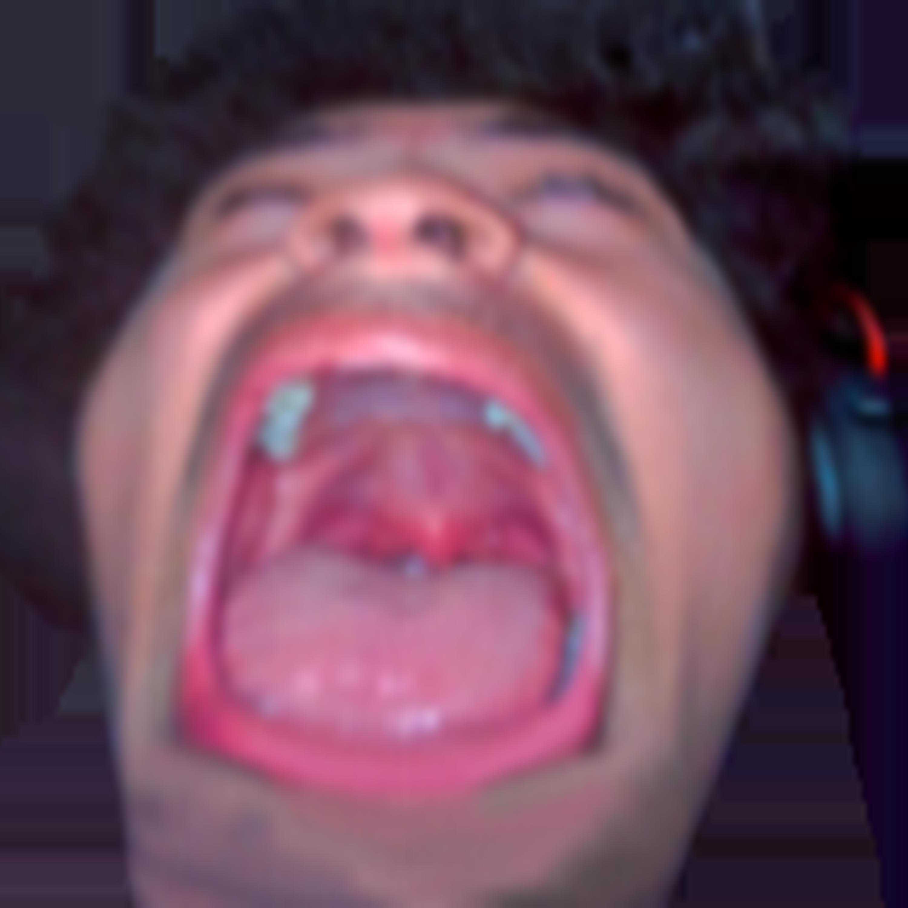 Релиз Shploink Overdose