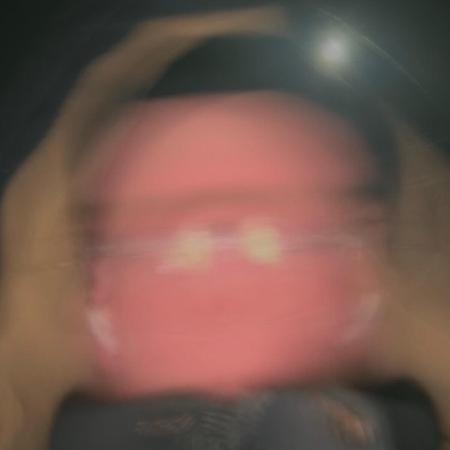 vxitixid