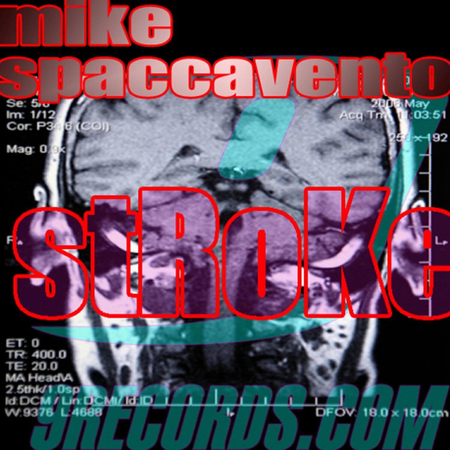Релиз Stroke