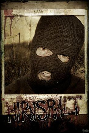 Hirnspalt