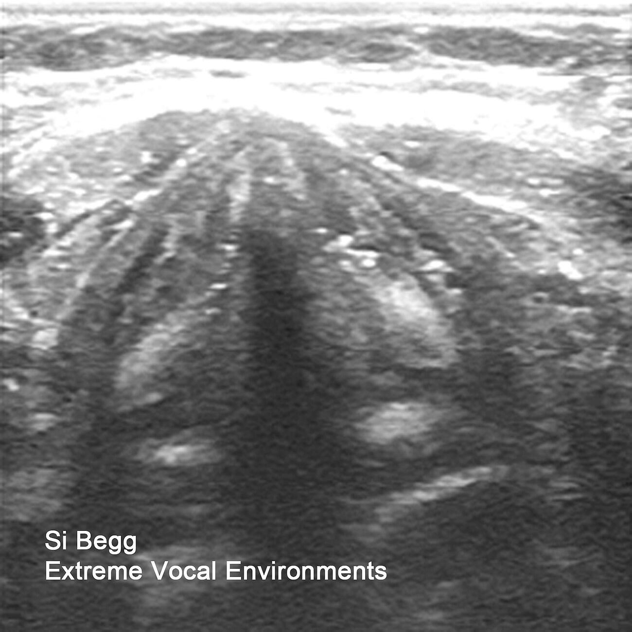 Релиз Extreme Vocal Environments
