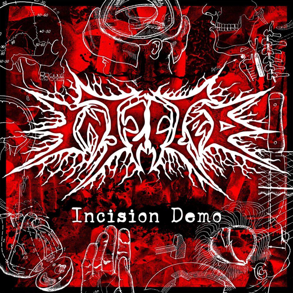 Релиз Incision