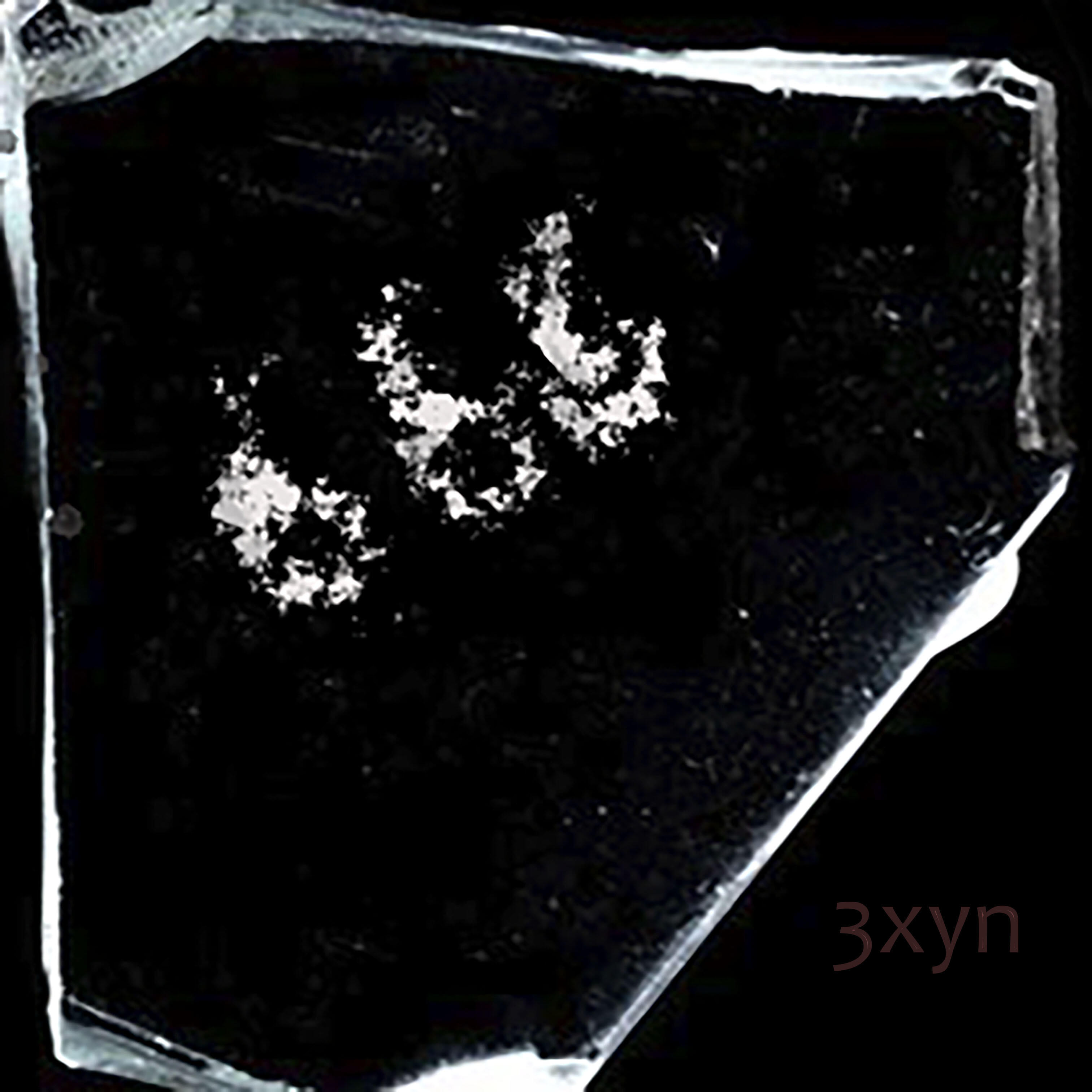 3xyn
