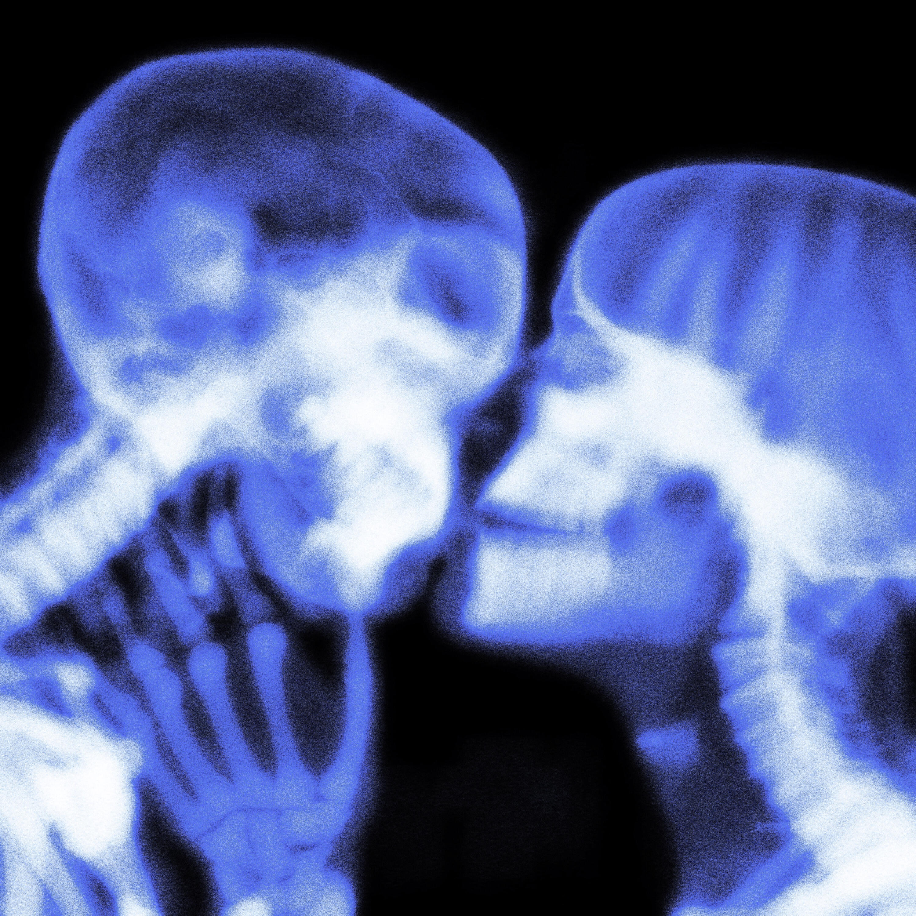 Релиз Черепная коробка
