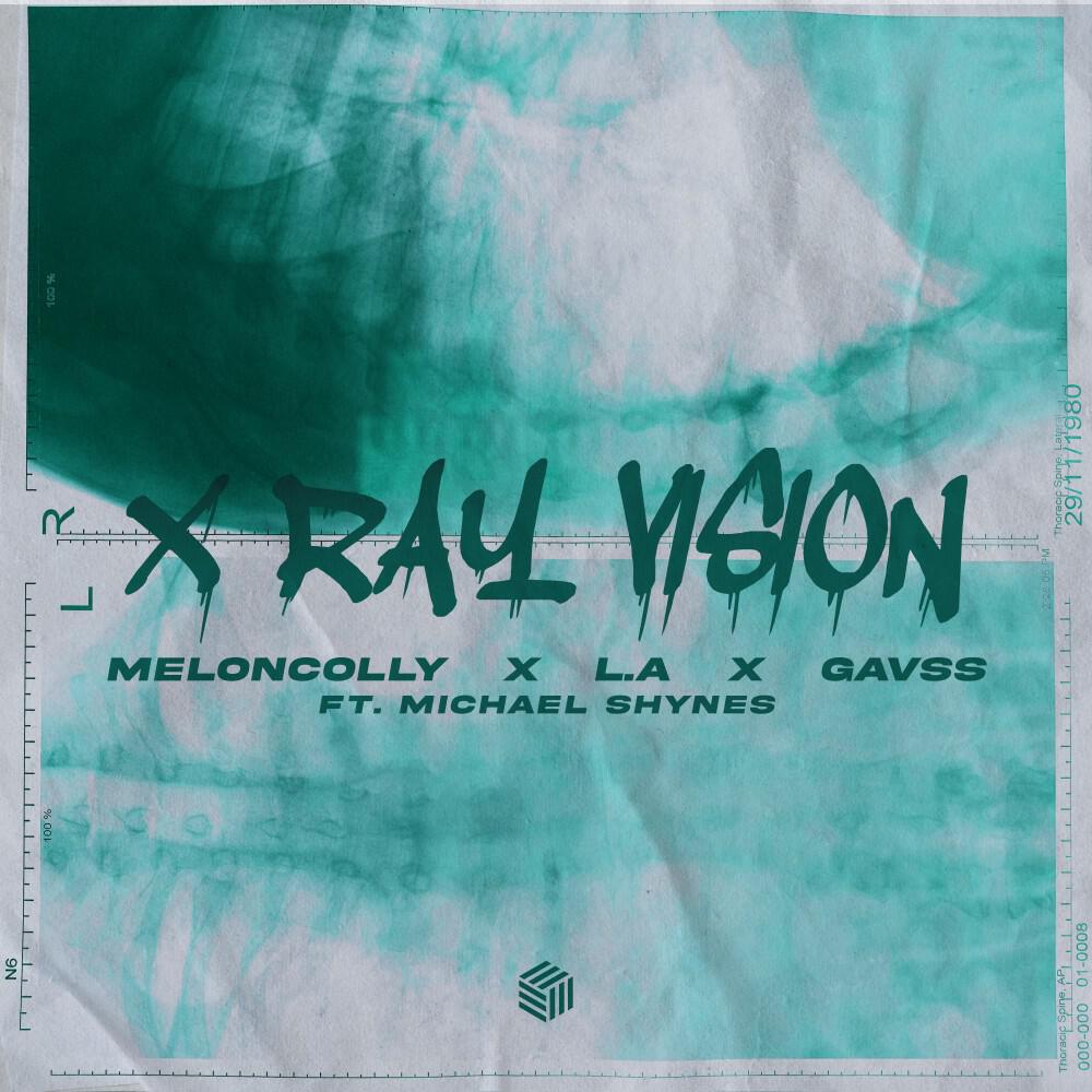 Релиз X Ray Vision