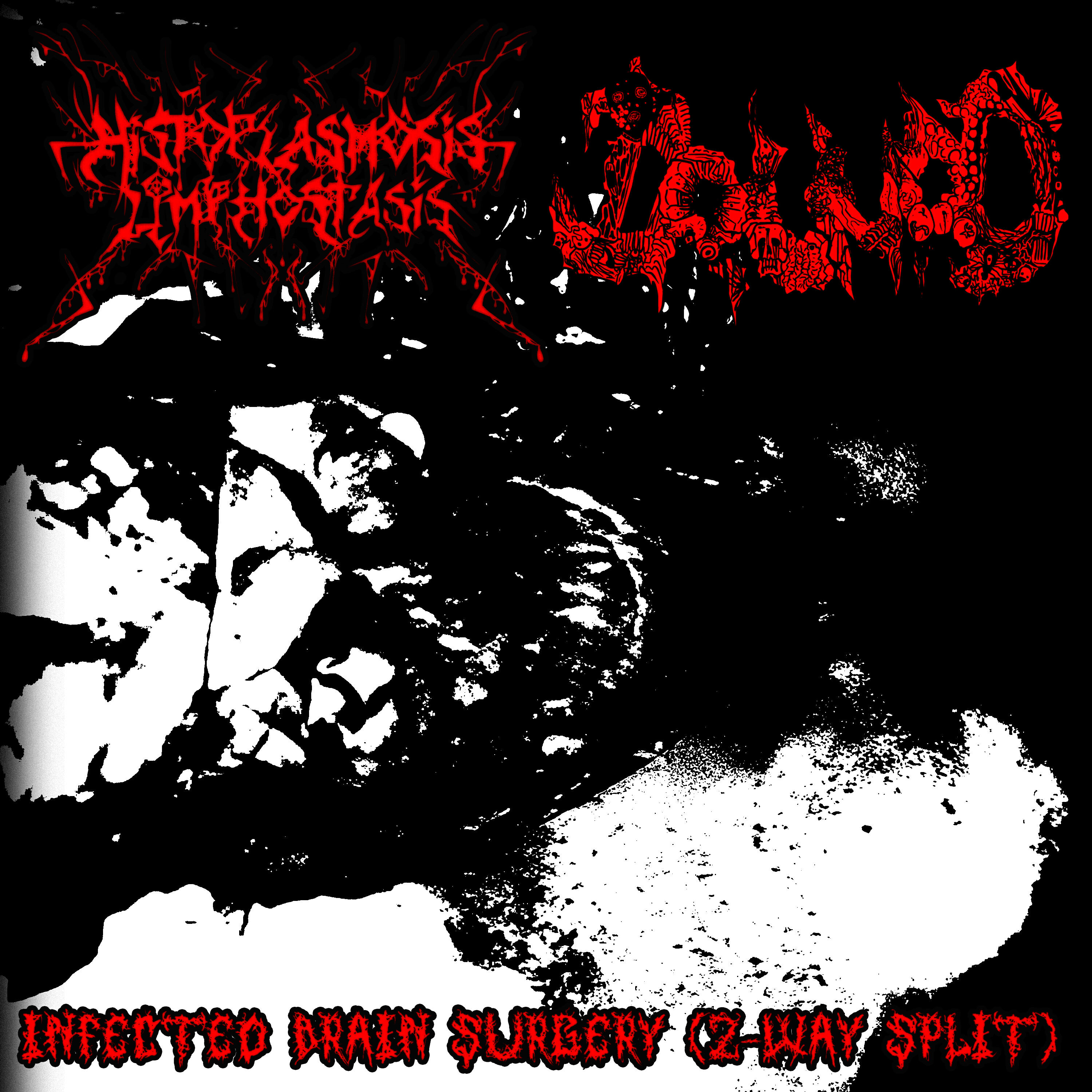 Релиз Infected Brain Surgery (2-Way Split)