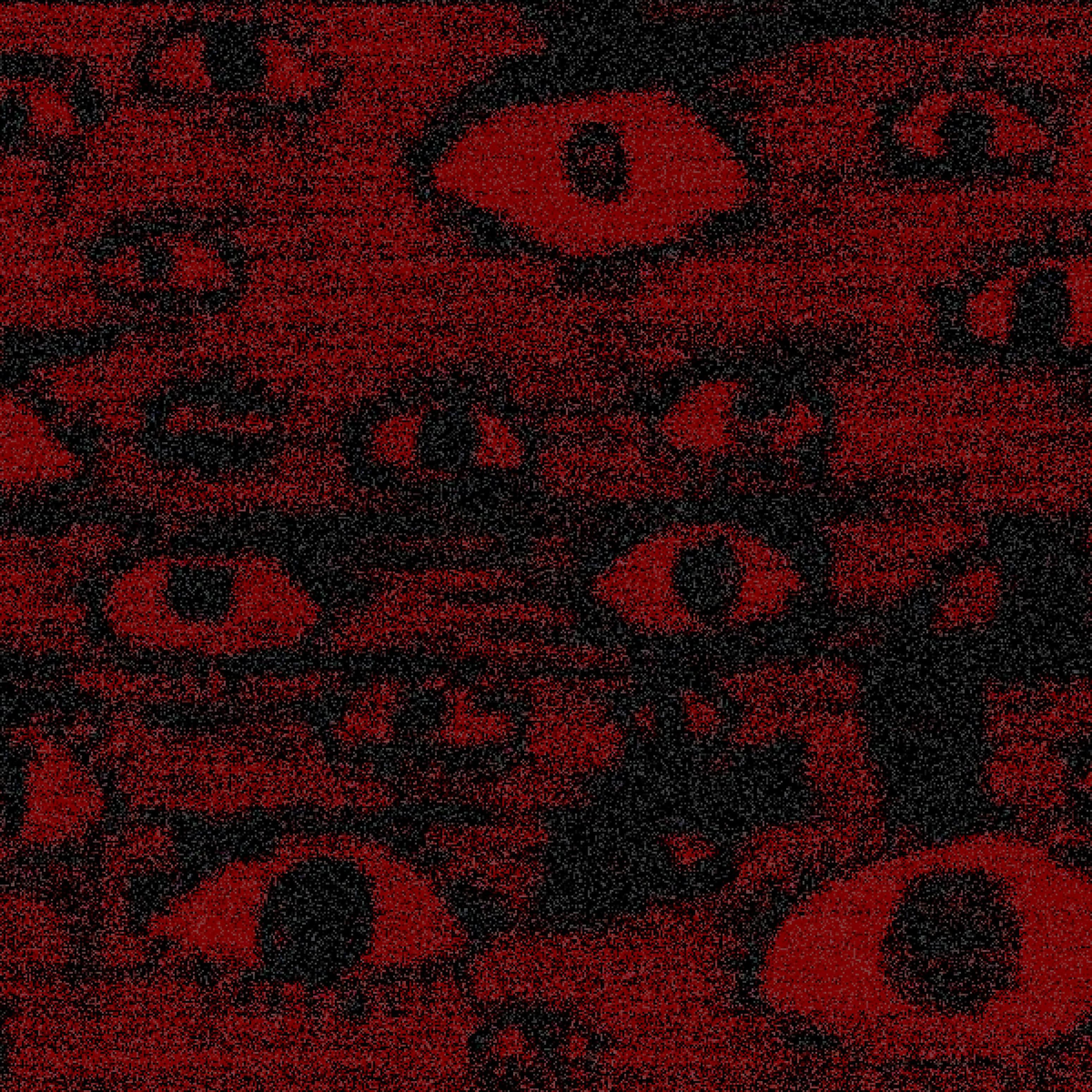 Релиз HEAD HURTS