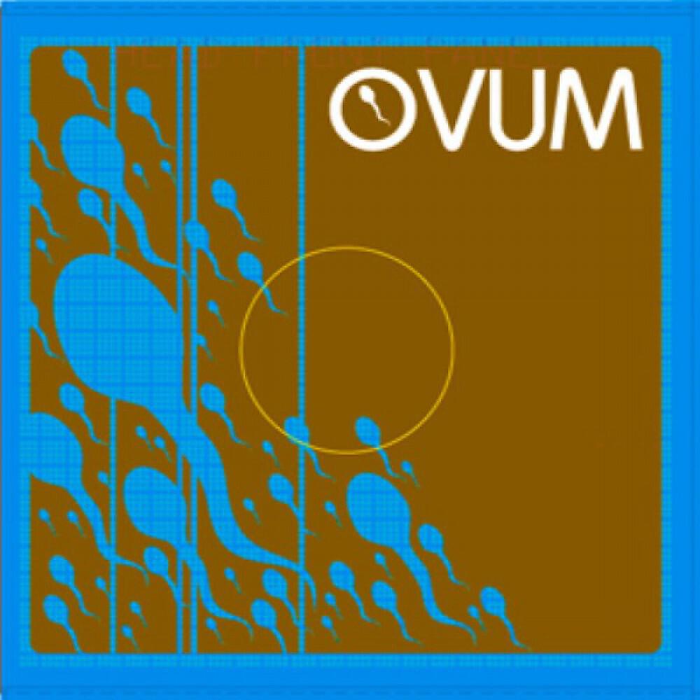 Трек Lost (Mazi & Duriez Remix)