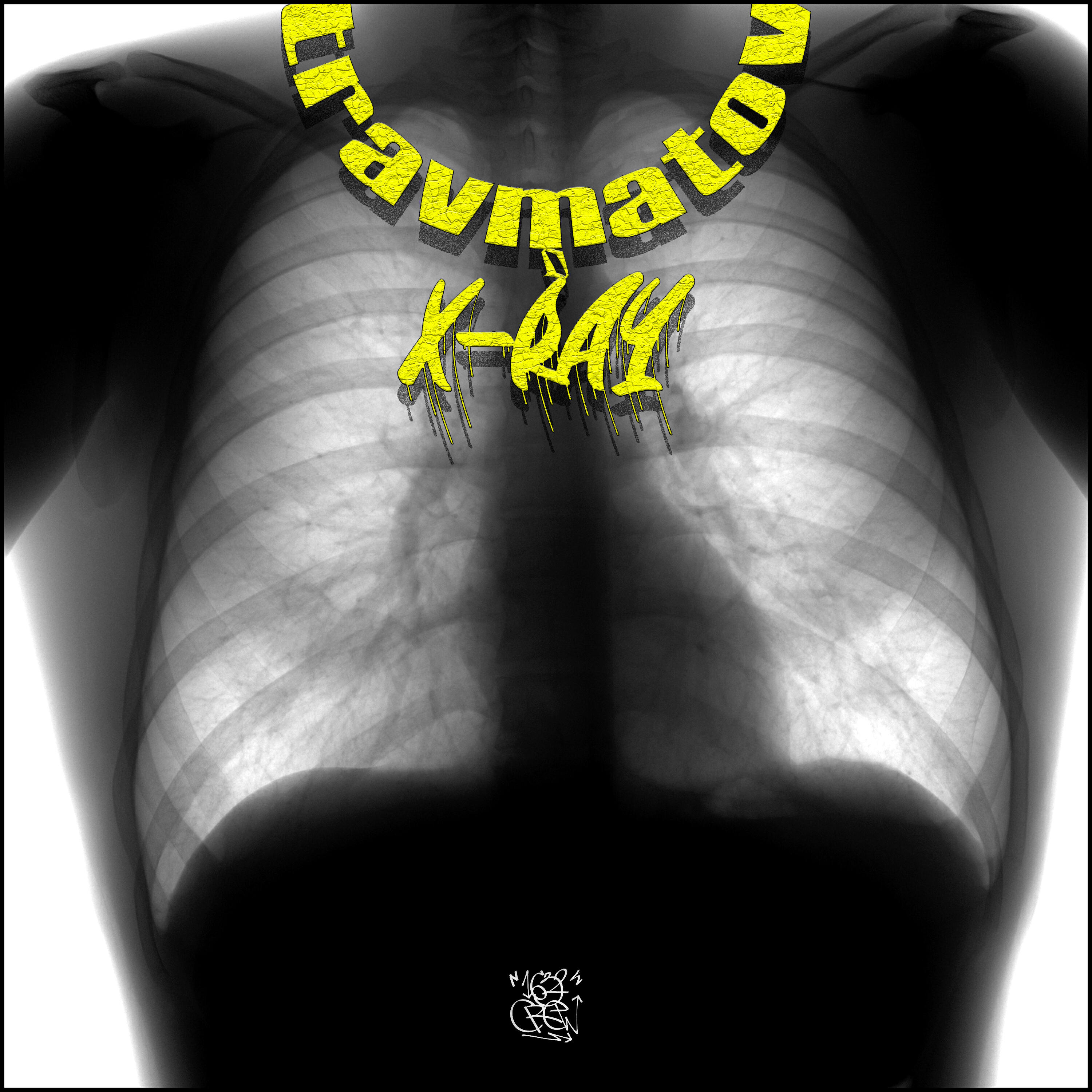 Релиз X-RAY