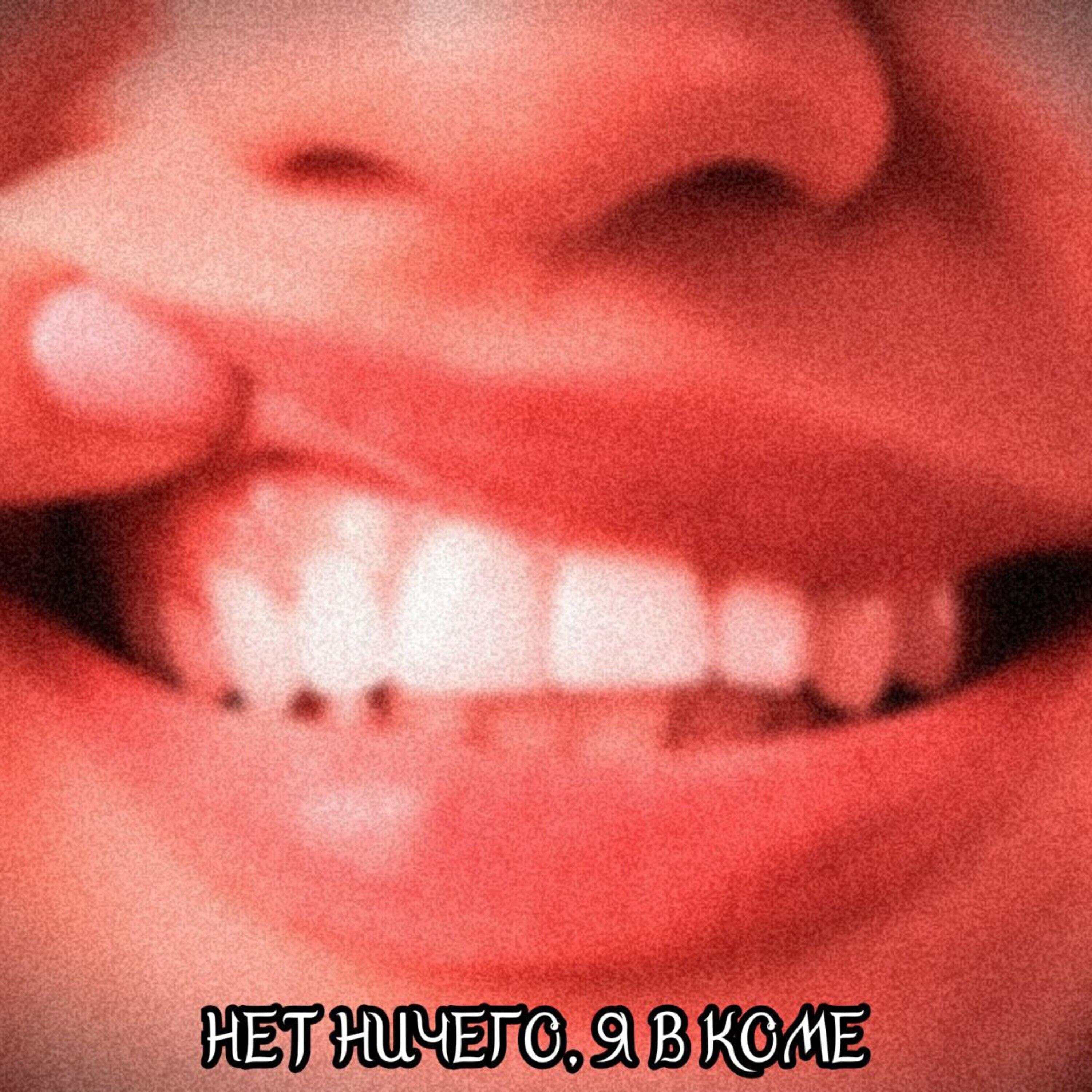 Релиз Нет ничего, я в коме