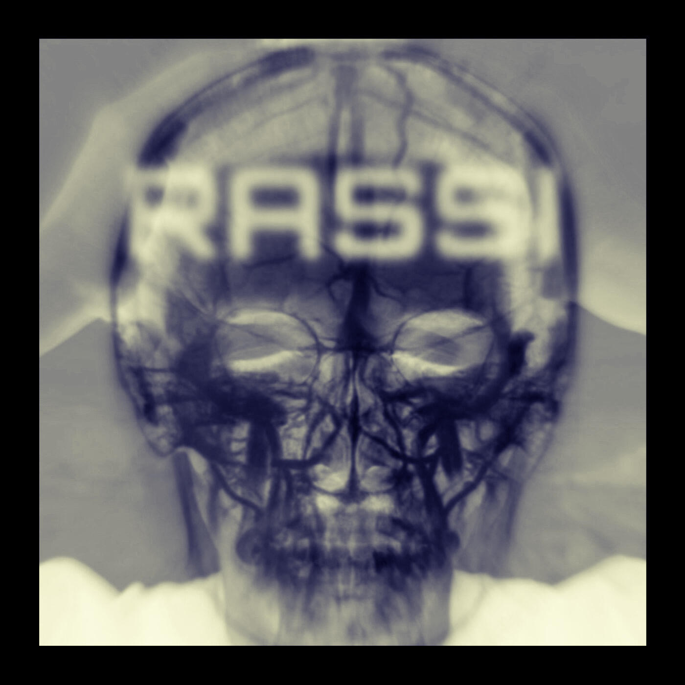 R W