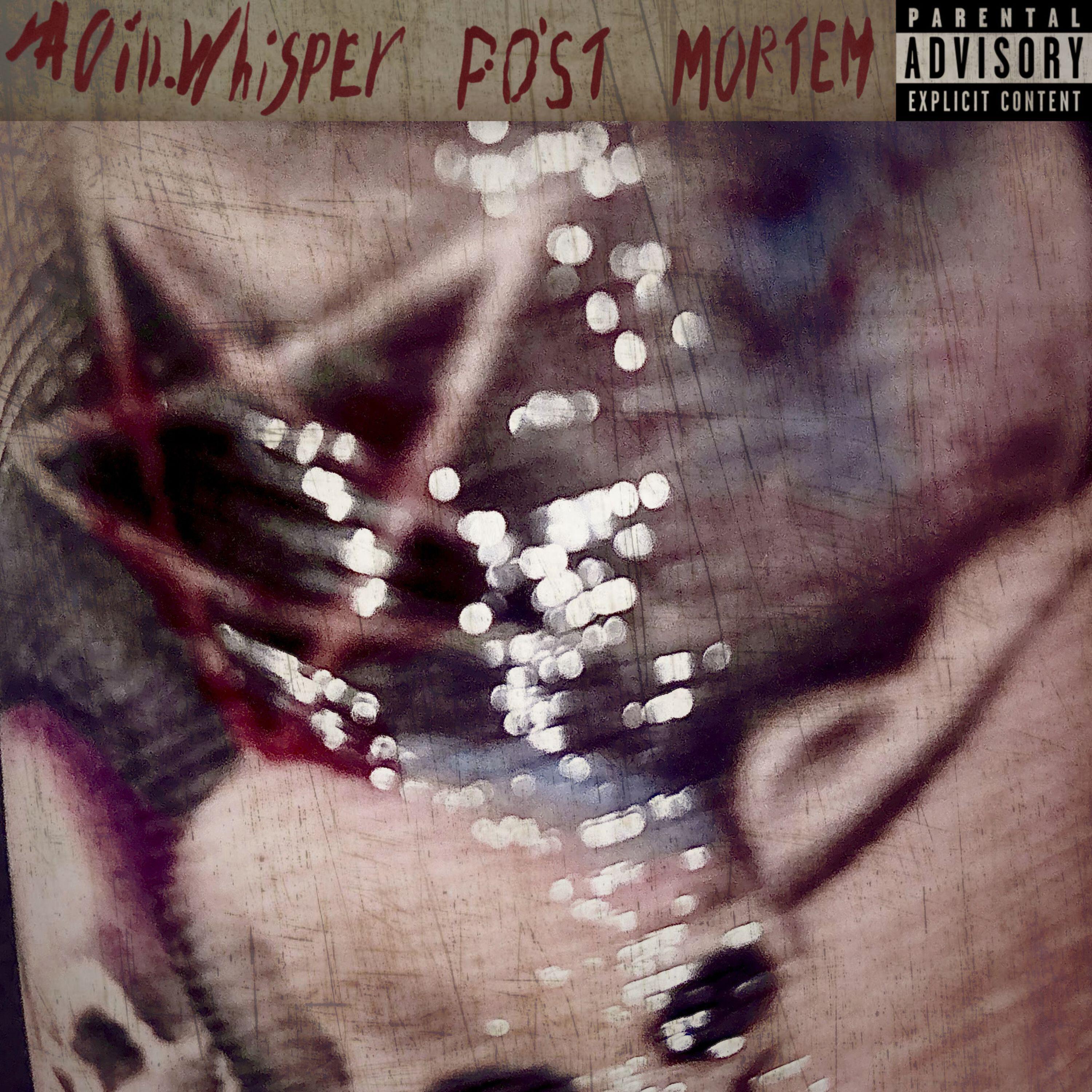 Релиз Post Mortem