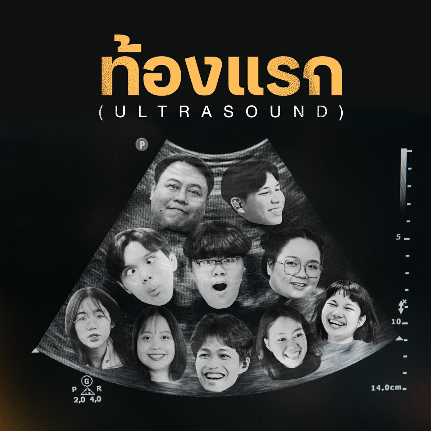 Релиз ท้องแรก (Ultrasound)