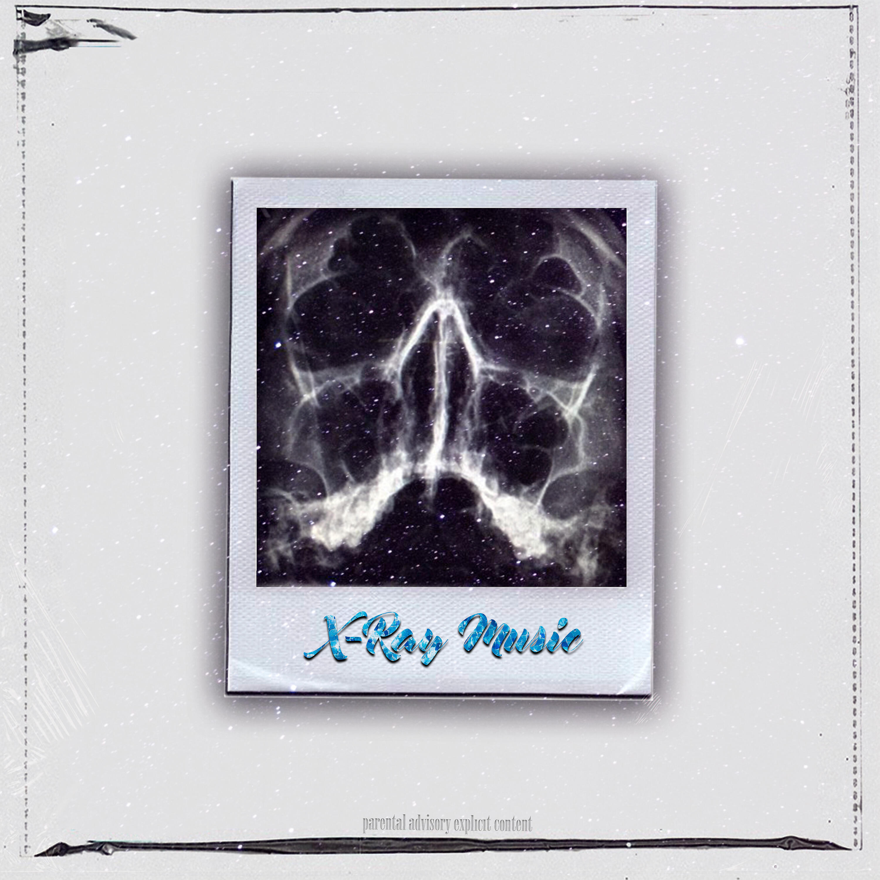 Релиз X-Ray Music