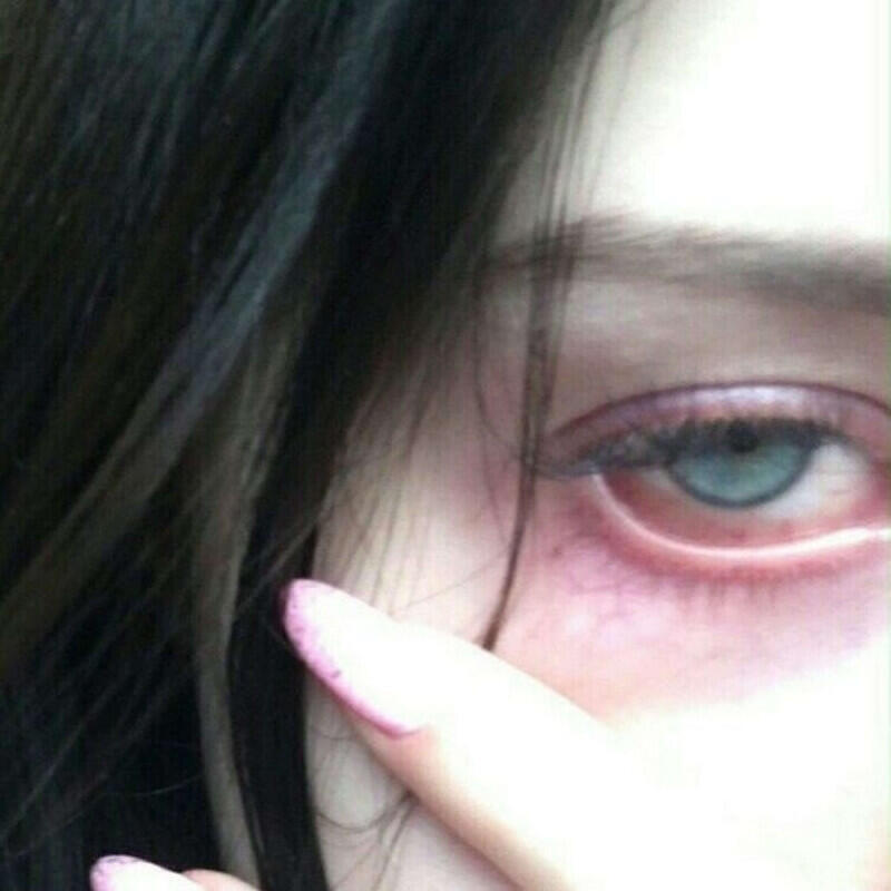 Релиз Suicide