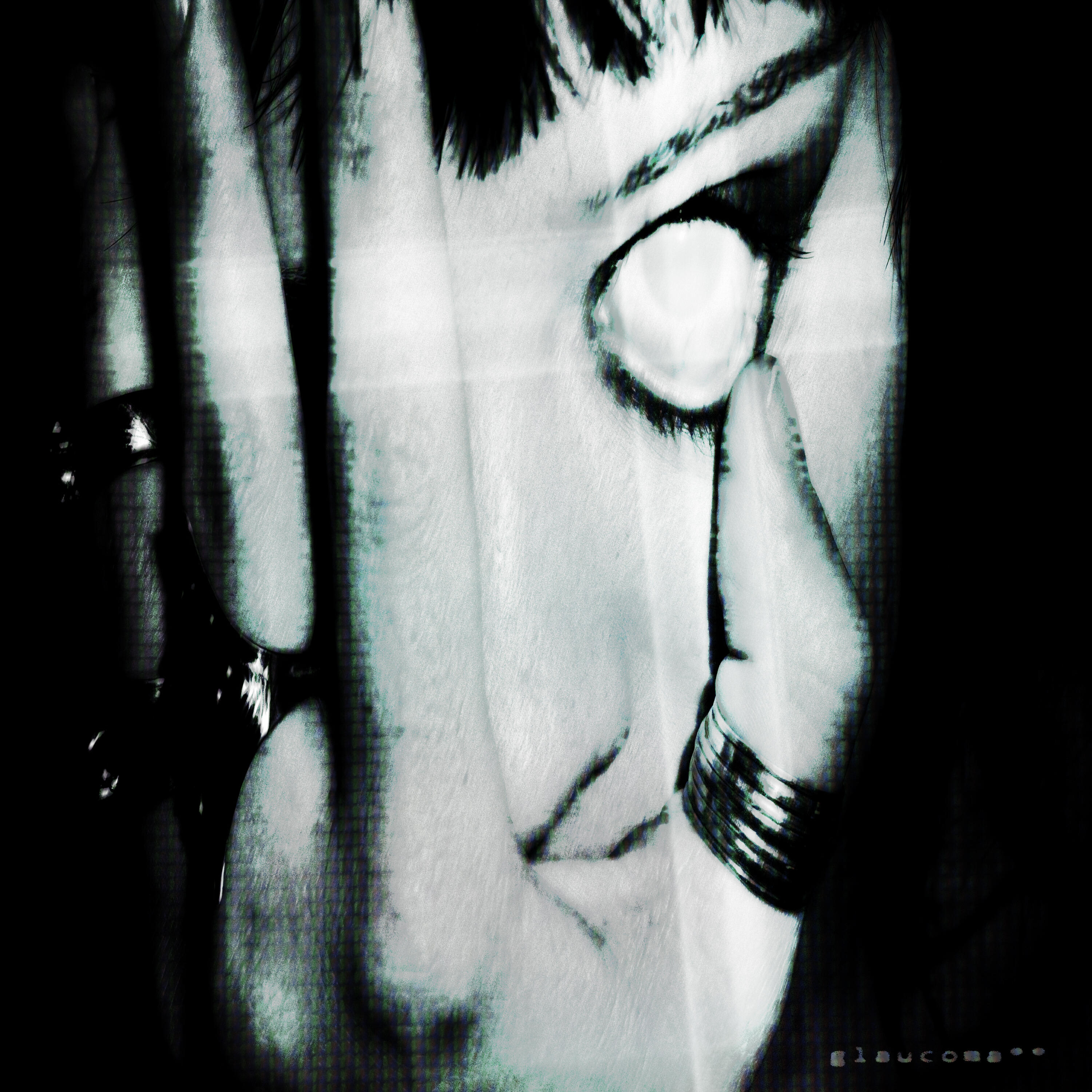 Релиз glaucoma**