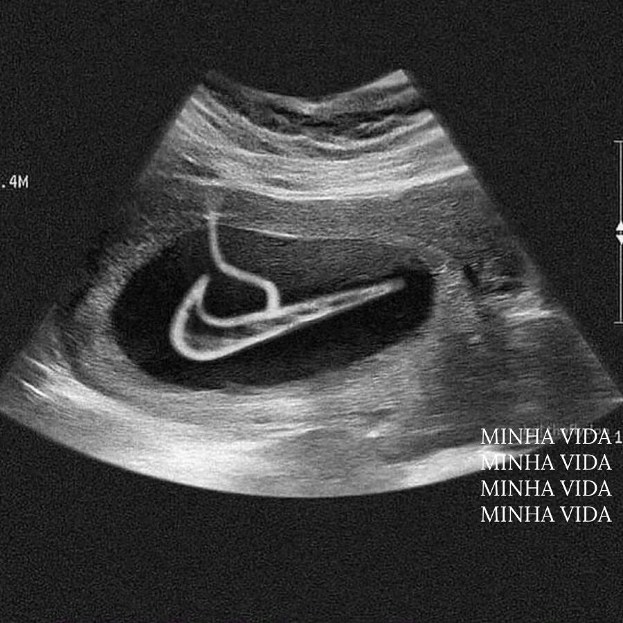 Релиз Minha Vida