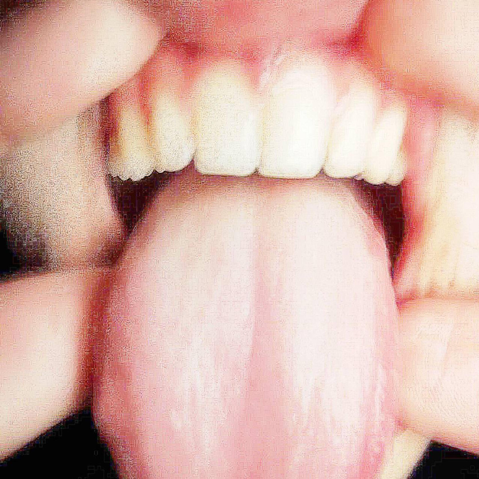 Релиз Teeth