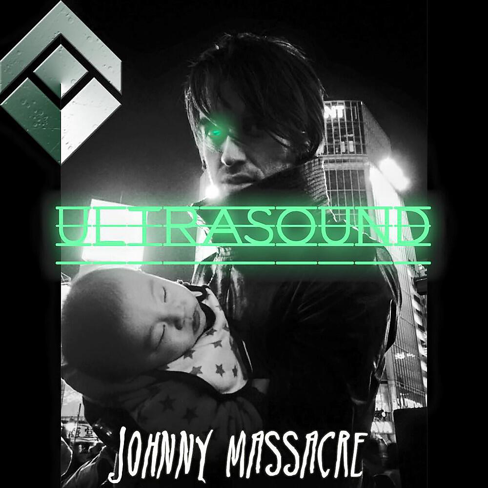 Релиз Ultrasound