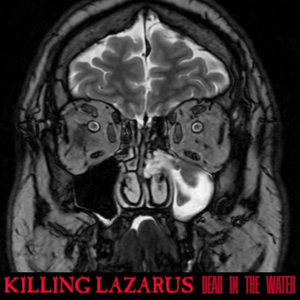 Killing Lazarus
