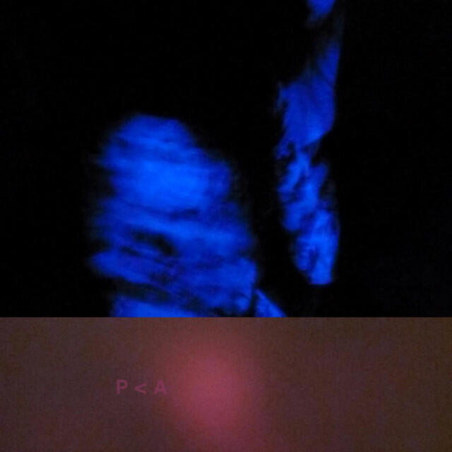 Релиз Dreamer's Drug EP