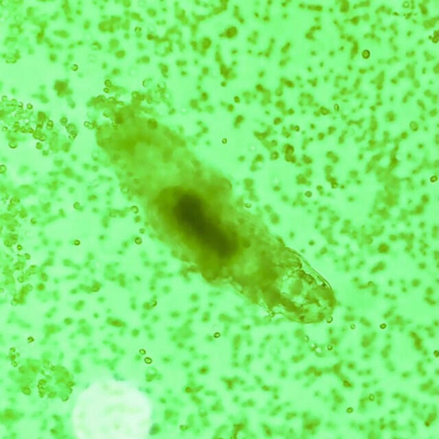 Релиз Microbailes
