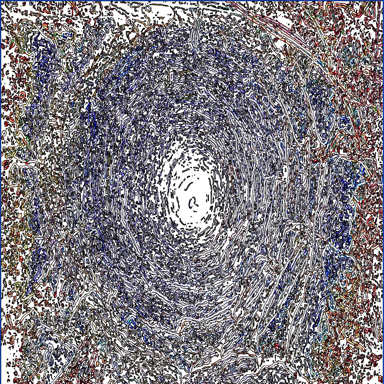 phokoso