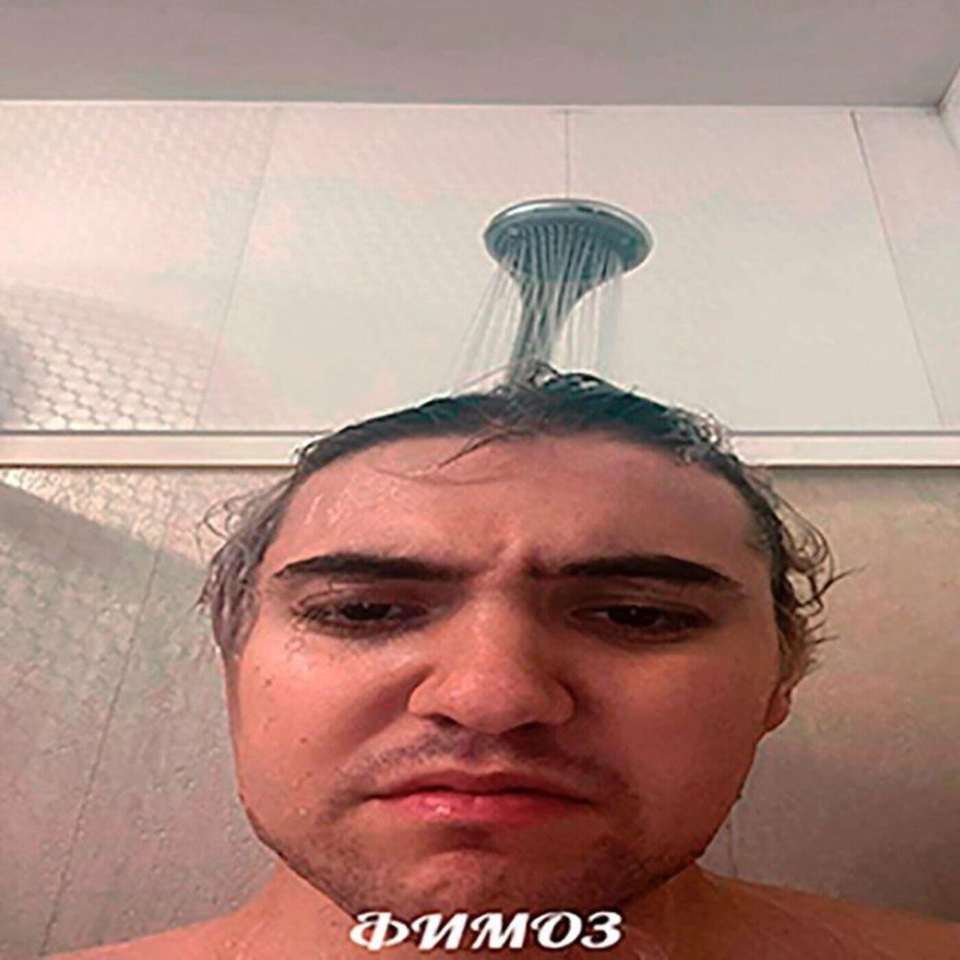 Релиз Фимоз