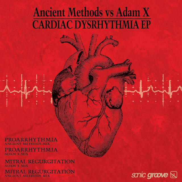 Релиз Cardiac Dysrhythmia