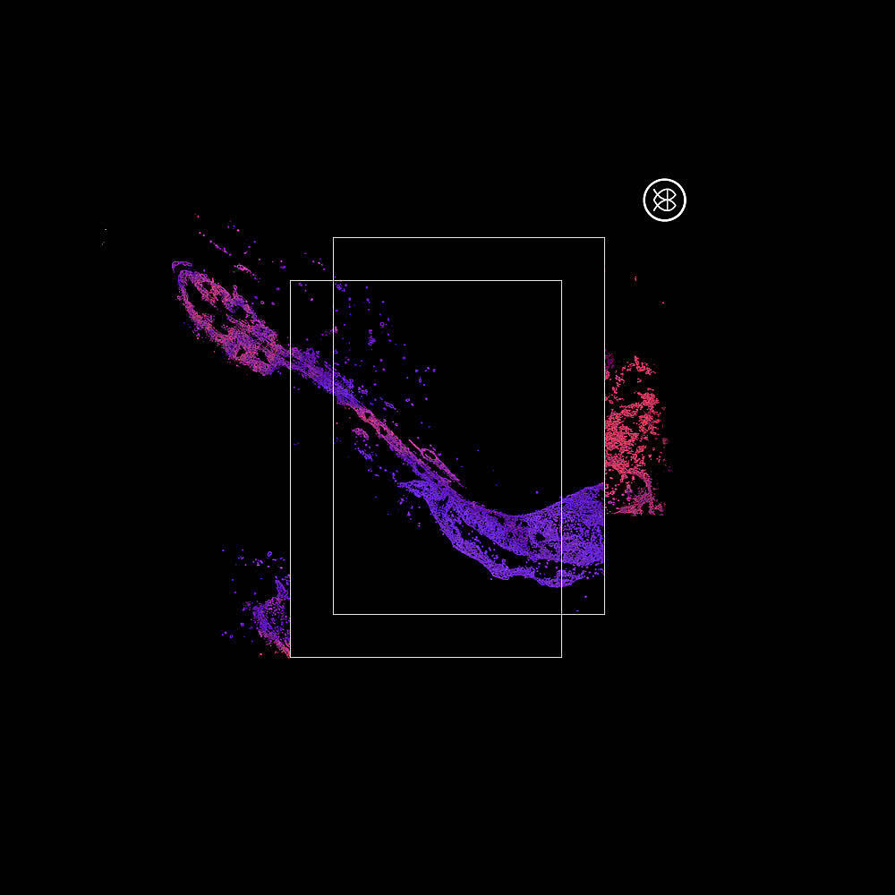 Релиз Nenúfares Perfectos