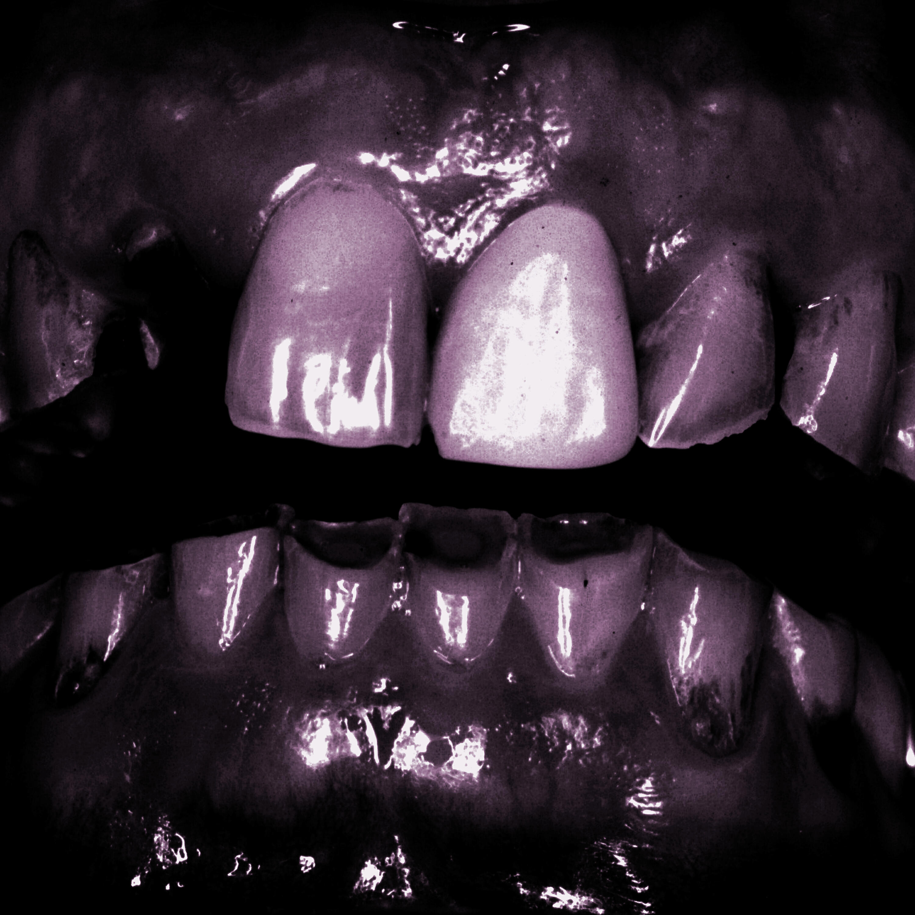 Релиз Grinding Teeth