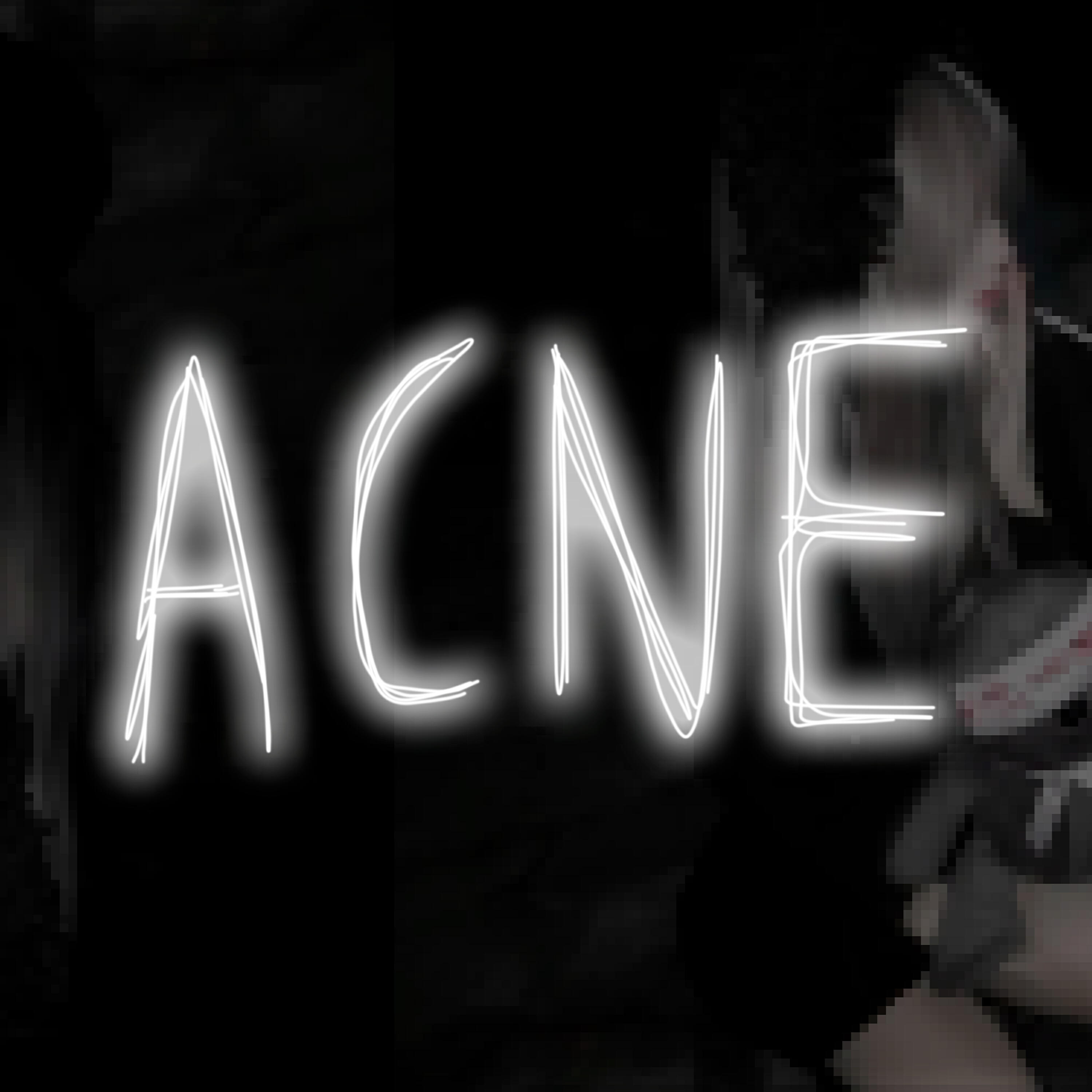 Релиз ACNE