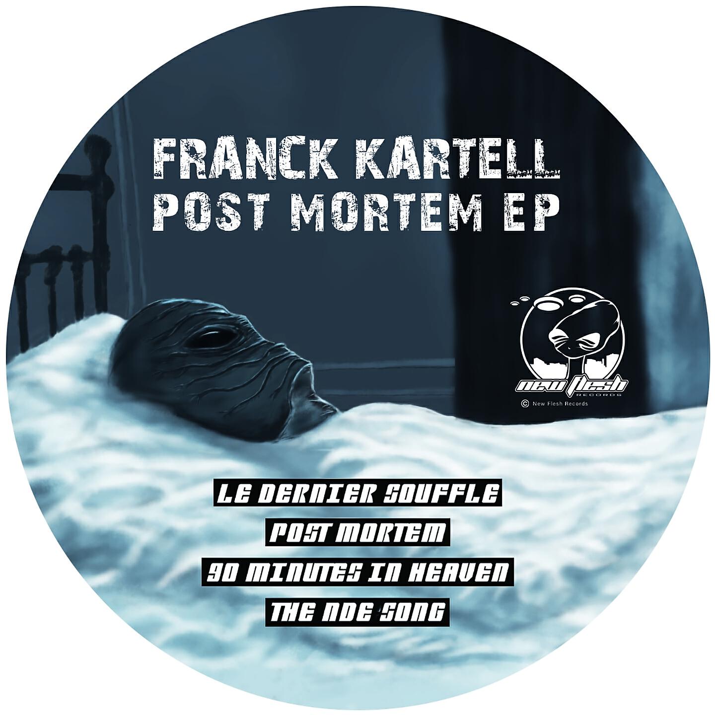 Релиз Post Mortem